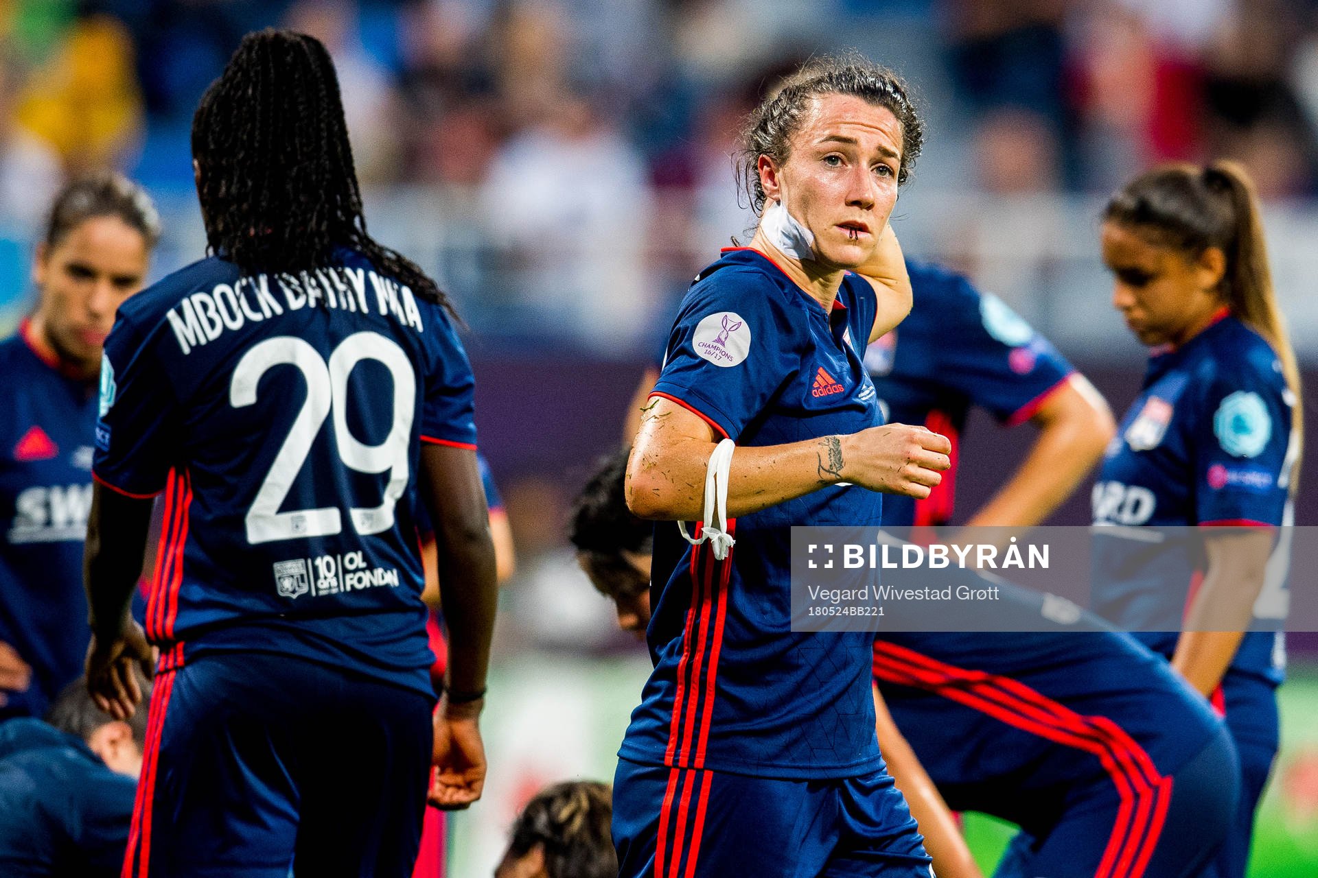 Lucy Bronze of Lyon with an injury