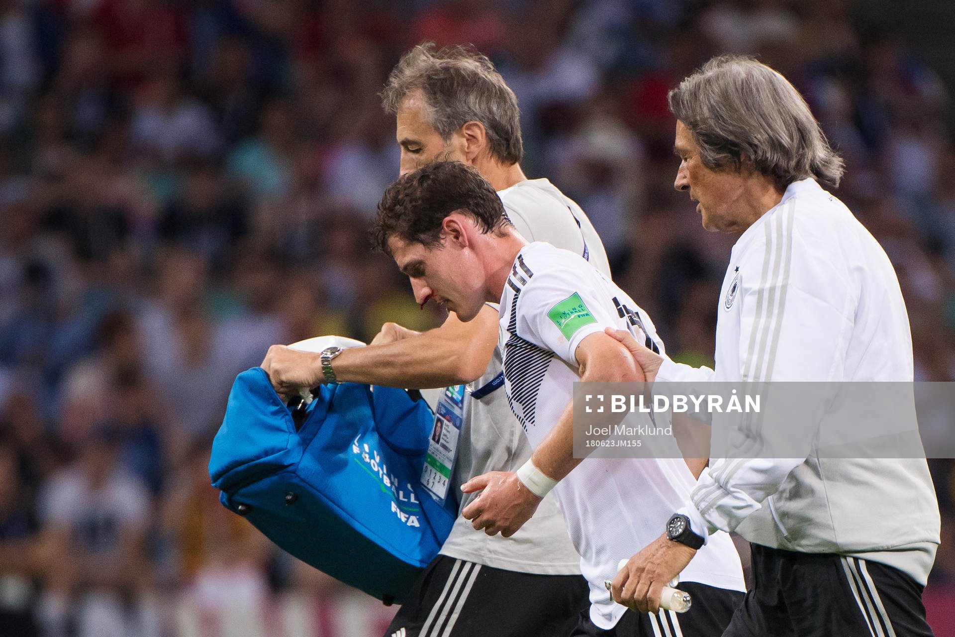Sebastian Rudy of Germany bleeding