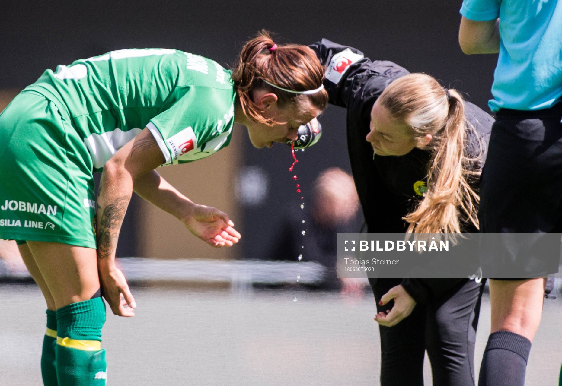 Hammarbys Amanda Johansson blöder näsblod