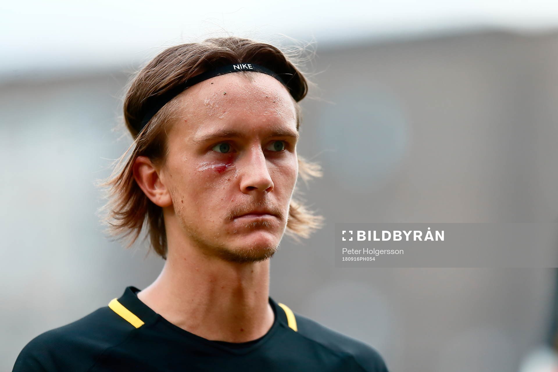 s Kristoffer Olsson deppar med skadad kind