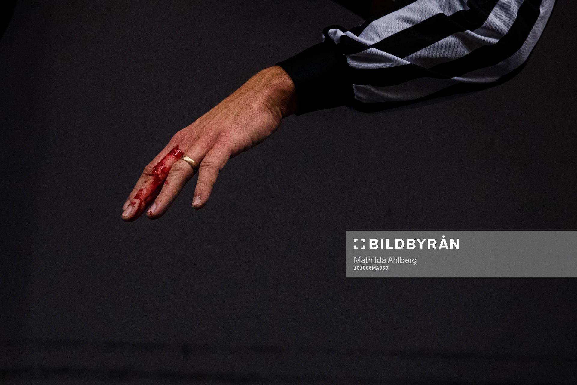 Domare Richard Magnusson med blödande finger