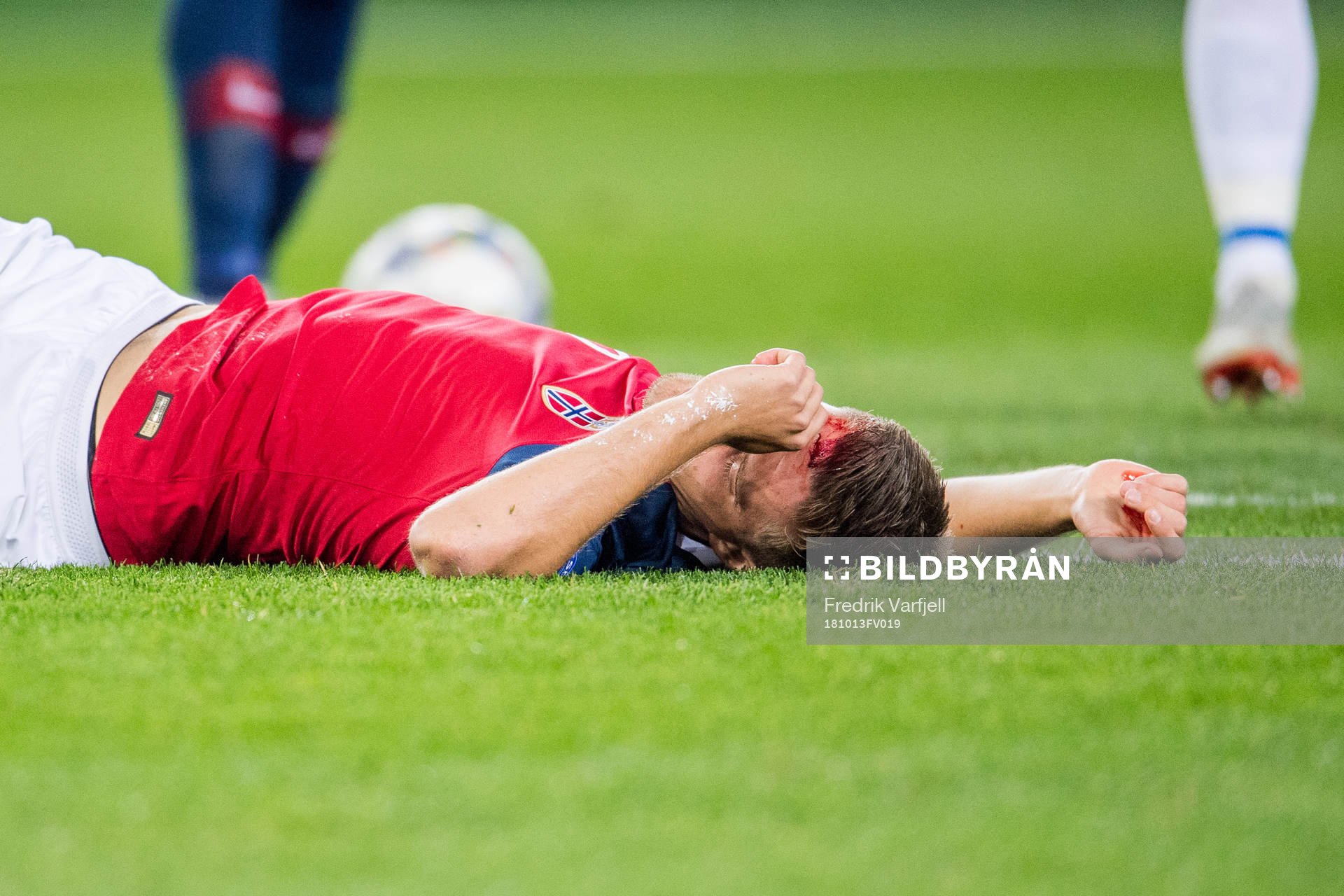 Markus Henriksen of Norway with an injury