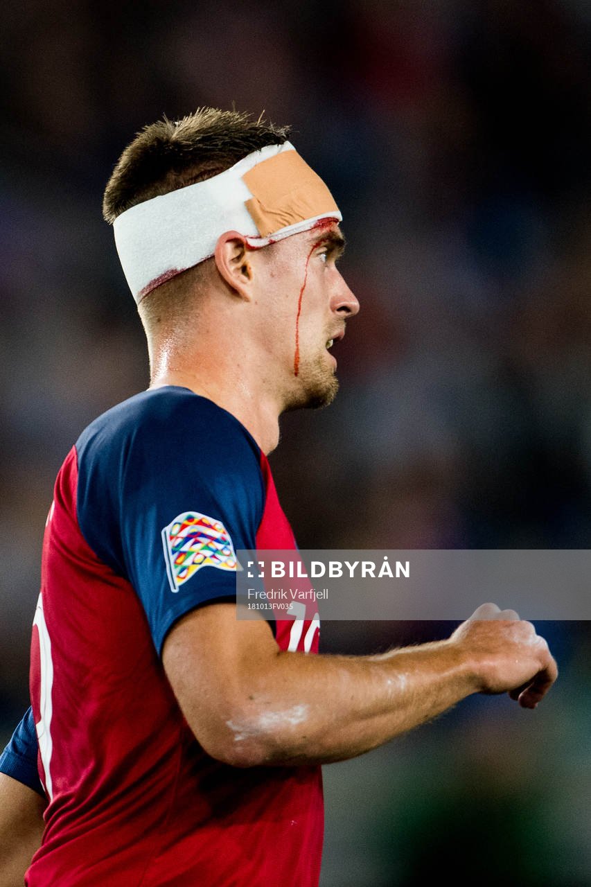 Markus Henriksen of Norway with an injury