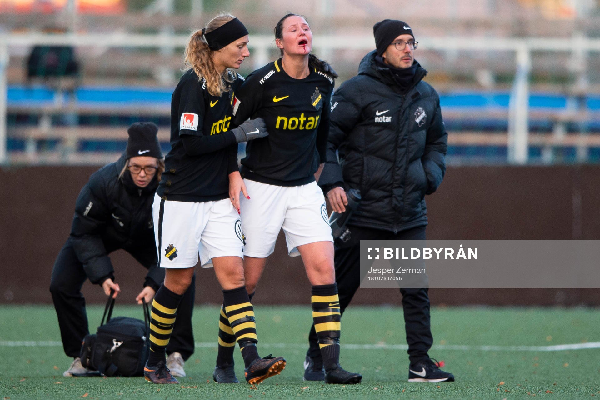 AIK:s Nicole Modin blöder från munnen efter en skada under fotbollsmatchen i Elitettan mellan AIK och Kungsbacka den 28 oktober 2018 i Stockholm.