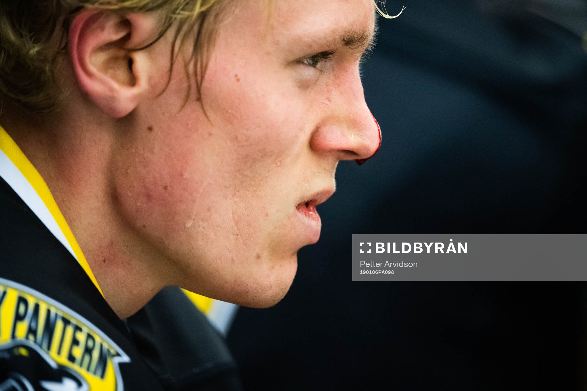 Panterns Albin Johansson skadad med blod rinnande längs