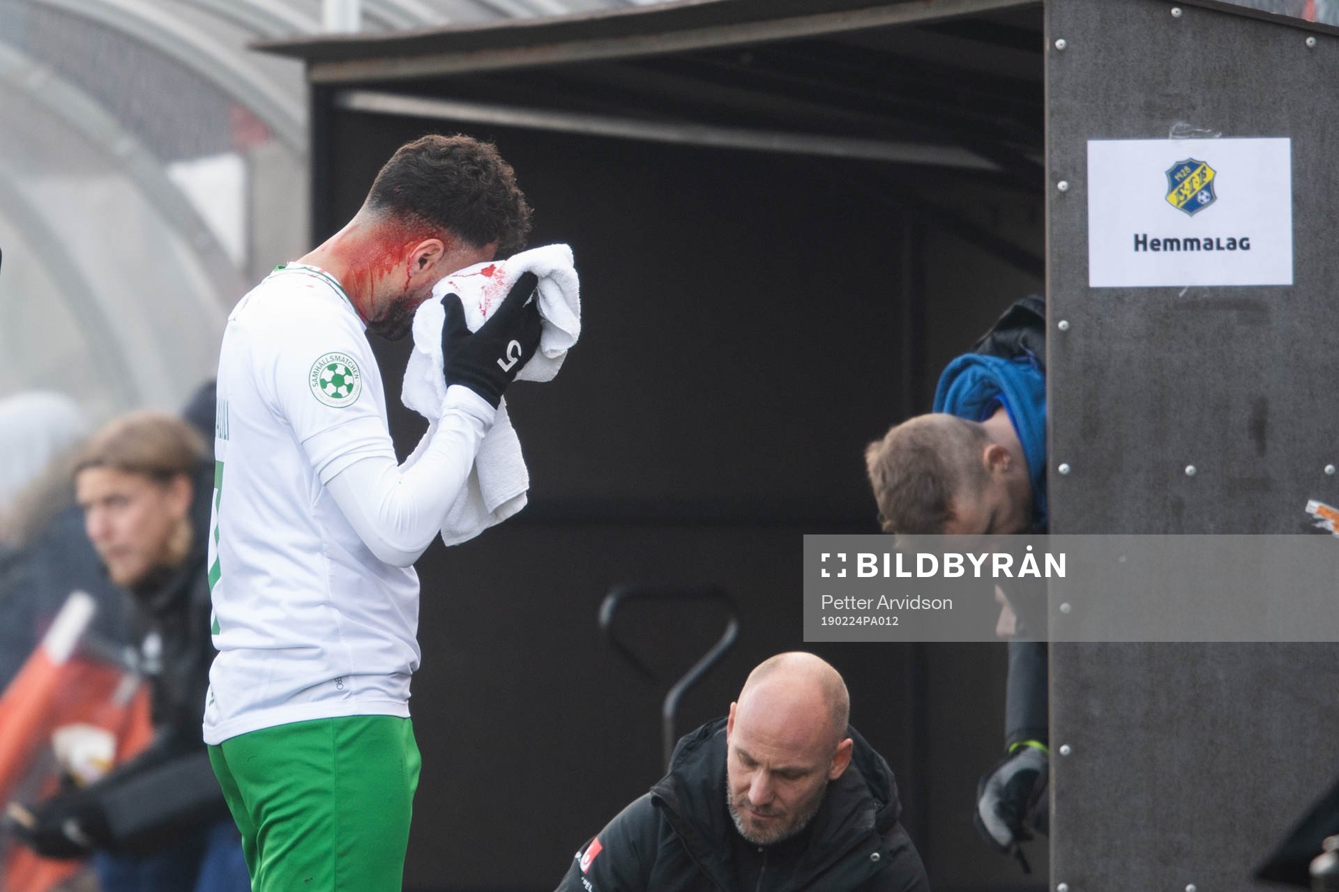 Hammarbys Imad Khalili blöder från huvudet