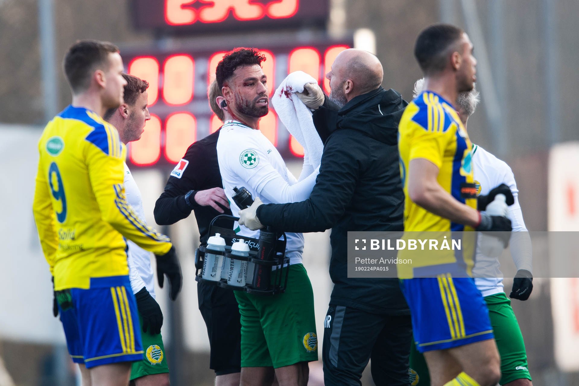Hammarbys Imad Khalili får vård då han blöder från