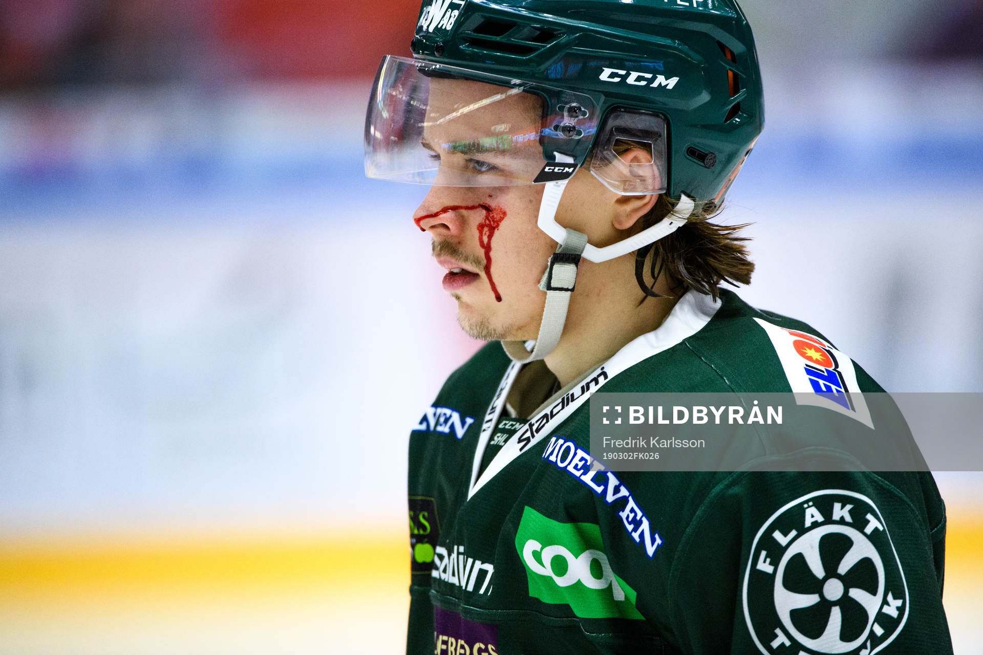 Färjestads Joakim Nygård blöder i ansiktet