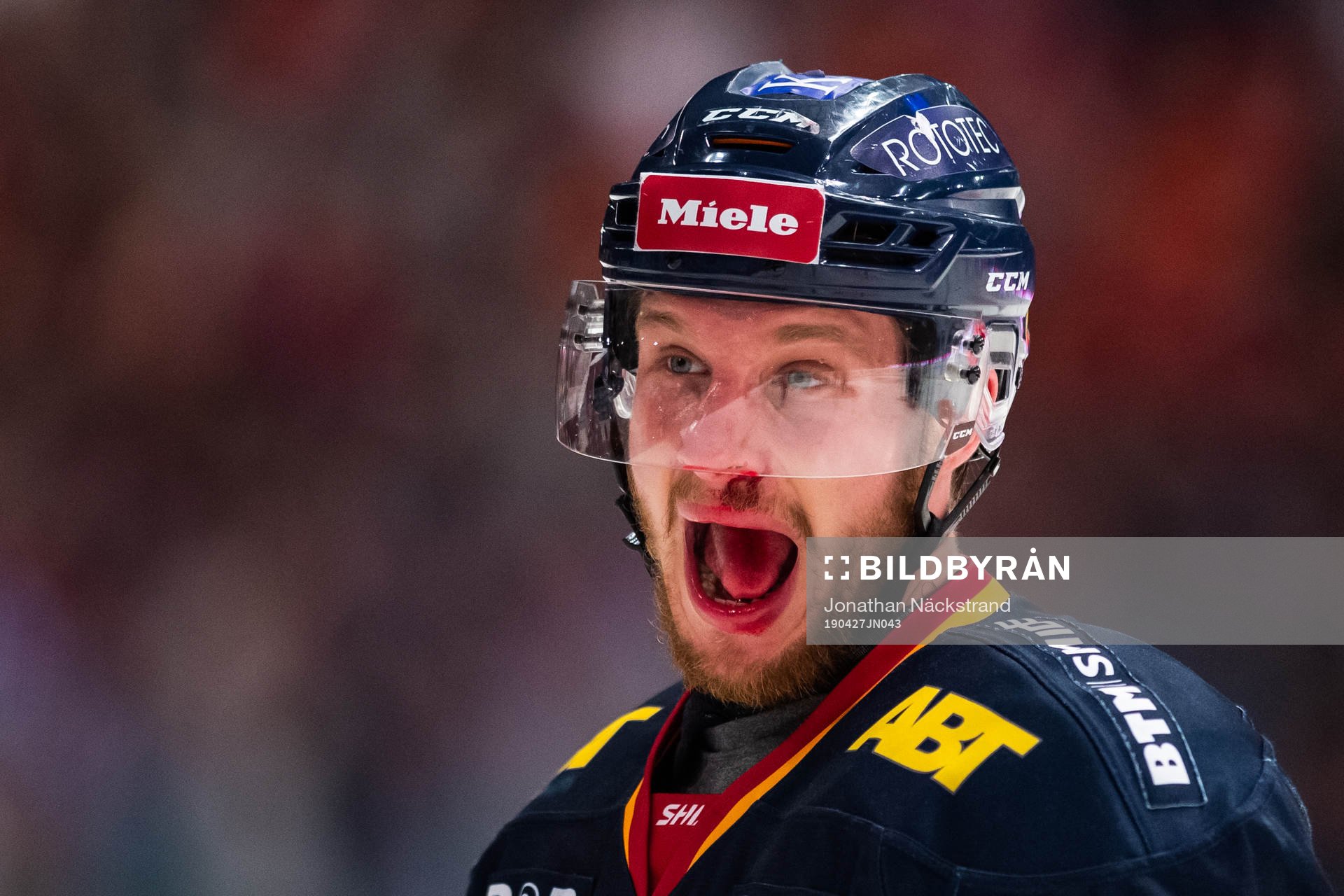 Djurgårdens Sebastian Strandberg blöder från näsan