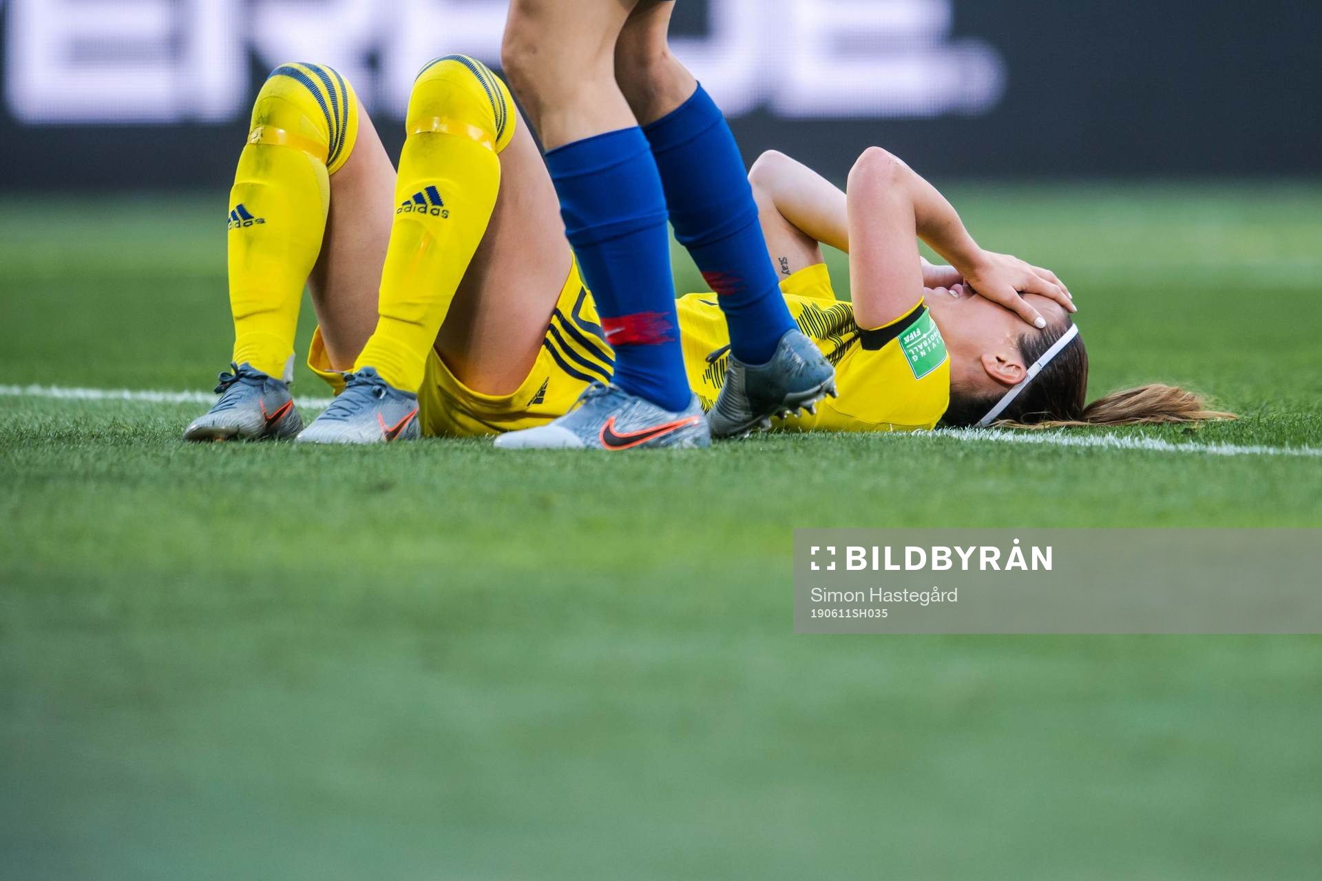 Kosovare Asllani of Sweden in pain