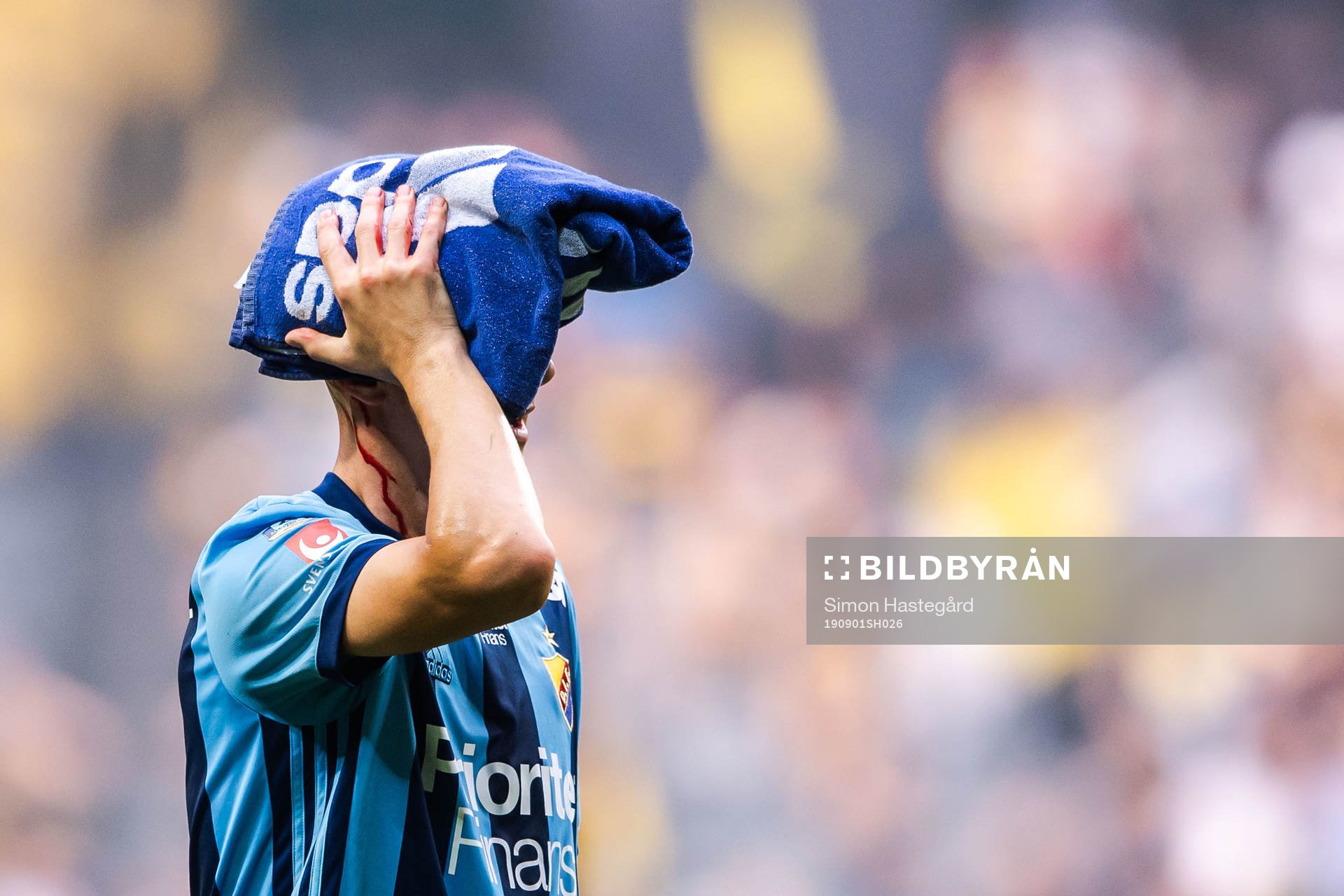 Djurgårdens Haris Radetinac blöder från huvet