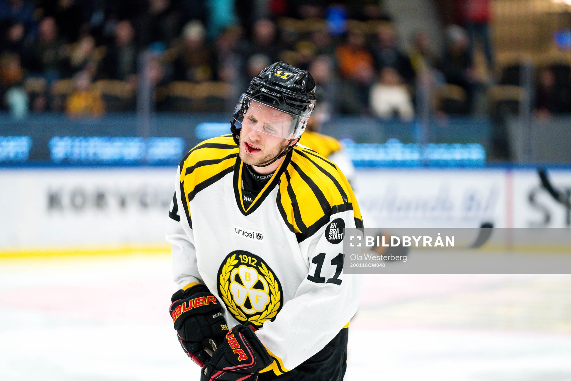 Brynäs Josef Ingman fick en klubba i ansiktet