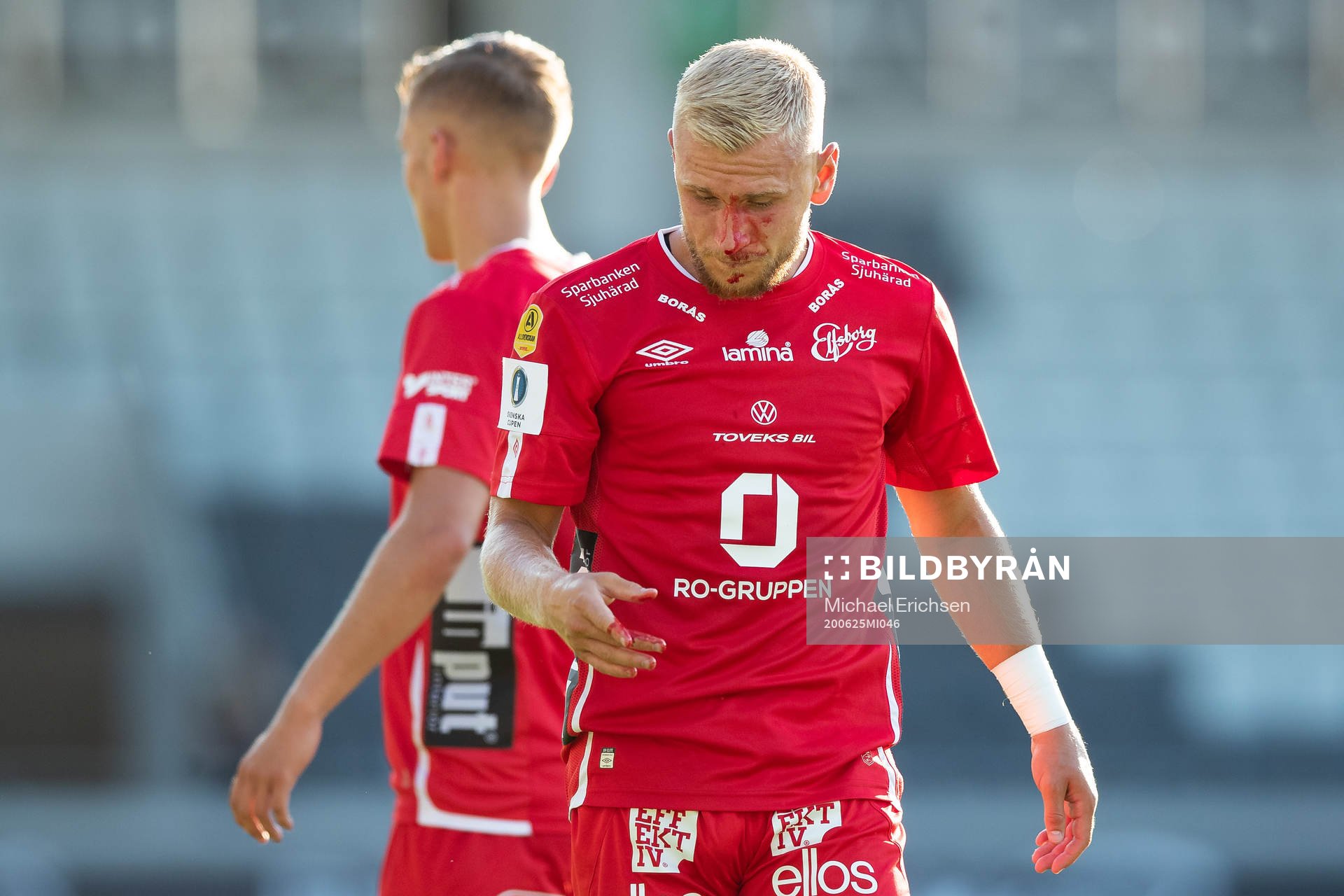 Elfsborgs Simon Strand blöder i ansiktet