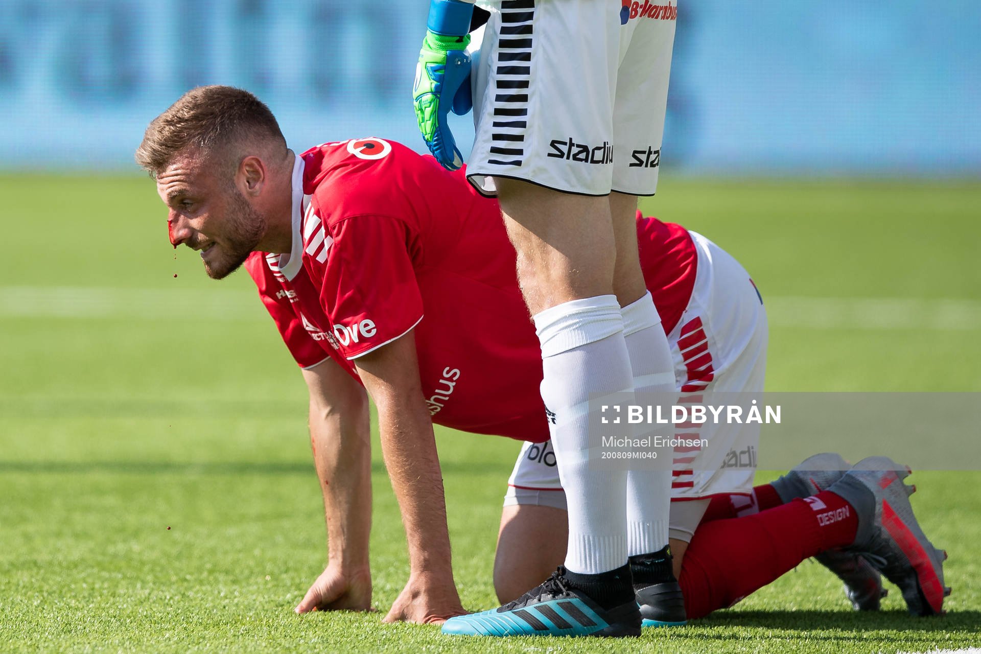 Kalmars Fidan Aliti blöder från näsan efter kollision under fotbollsmatchen i Allsvenskan mellan Häcken och Kalmar den 9 augusti 2020 i Göteborg.