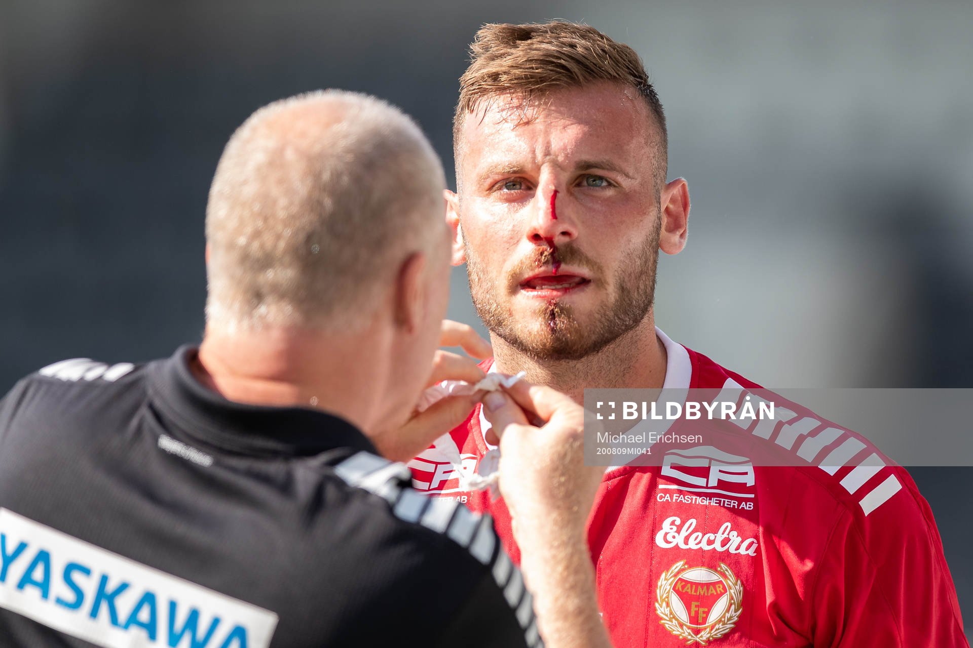 Kalmars Fidan Aliti blöder från näsan
