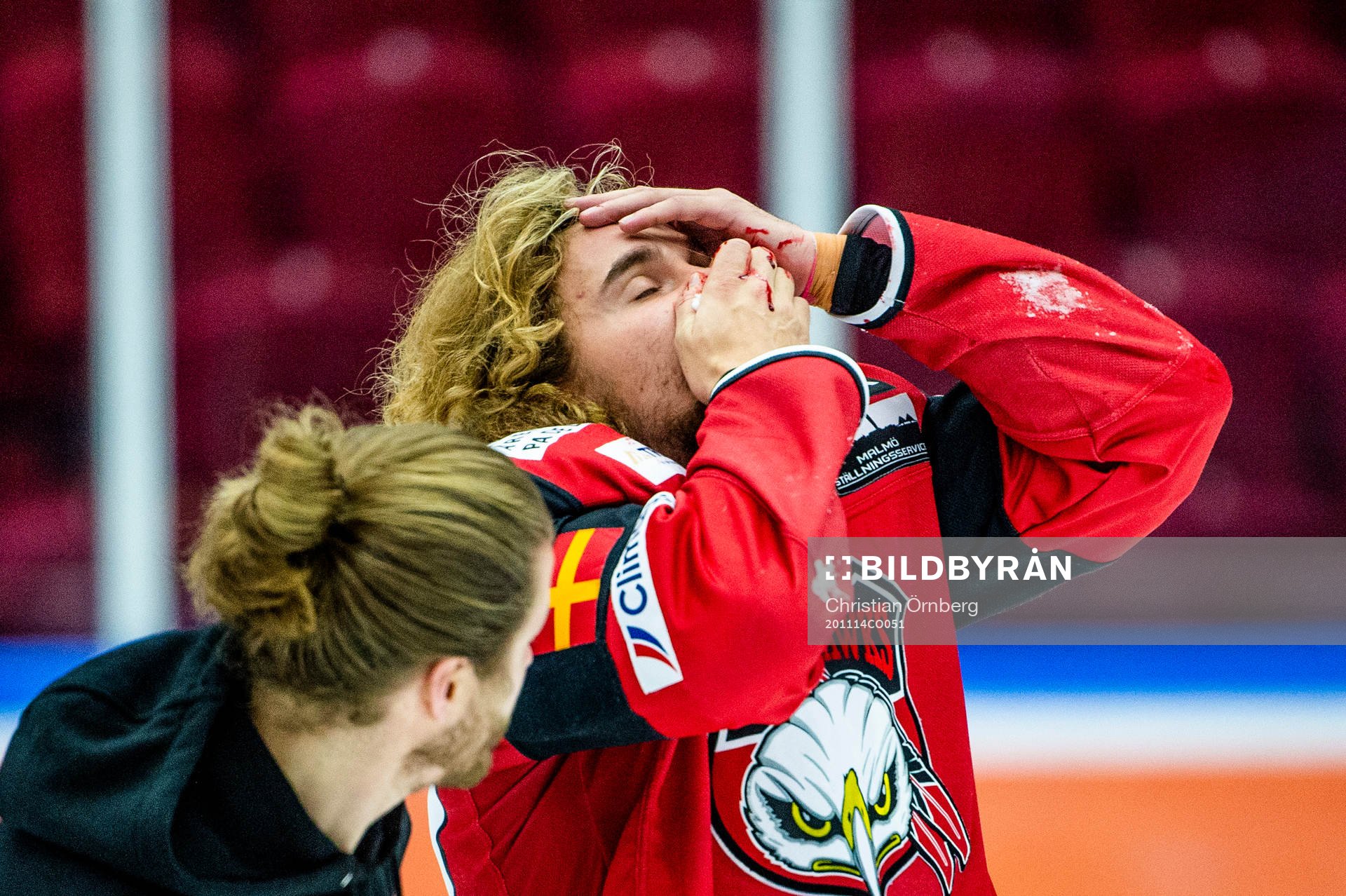 Malmö Redhawks Adam Brodecki blöder från ansiktet
