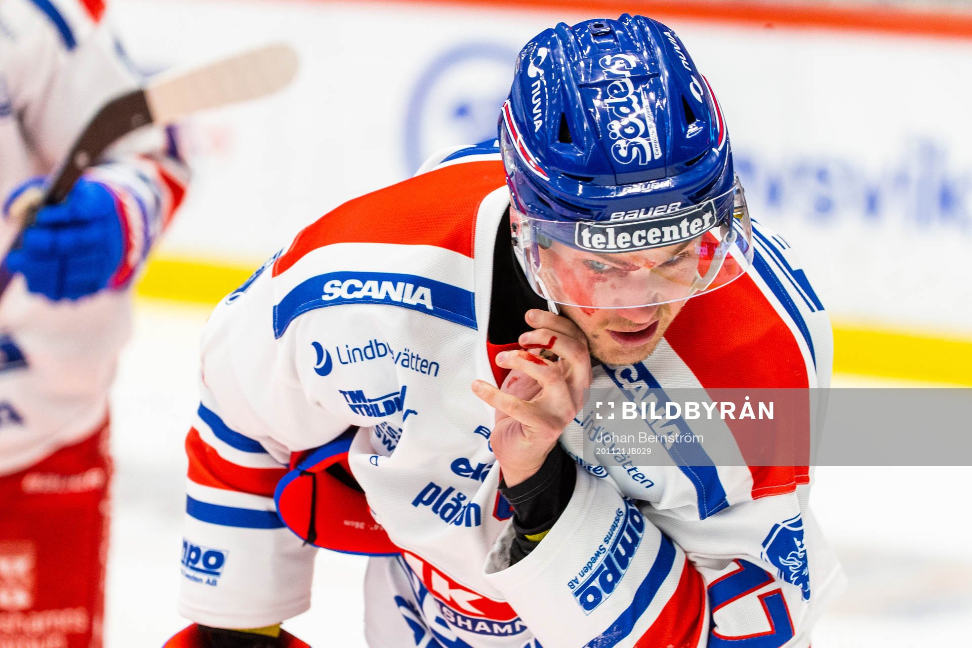 Oskarshamns Jonas Engström blöder i ansiktet