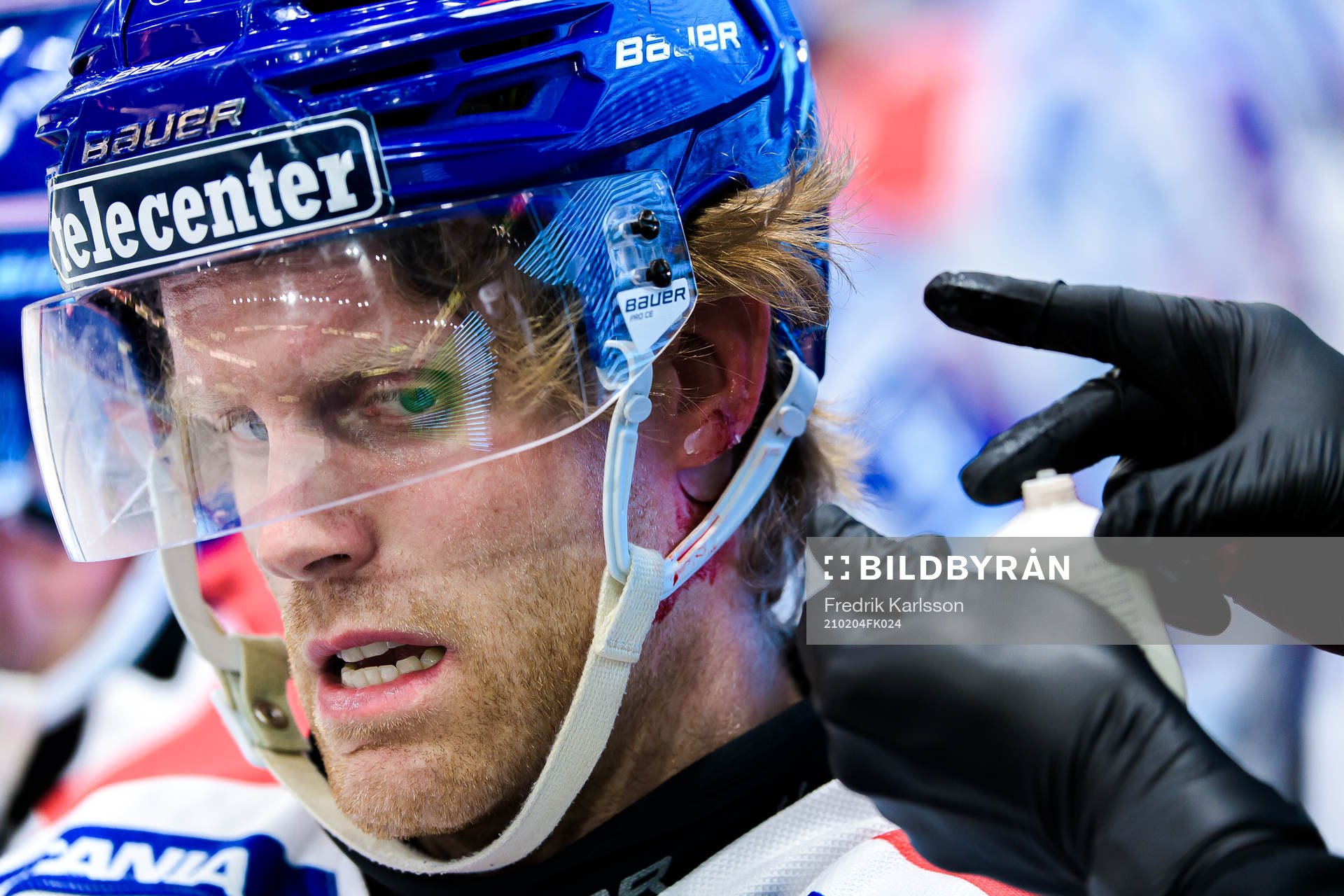 Oskarshamns Philip Samuelsson blöder från örat