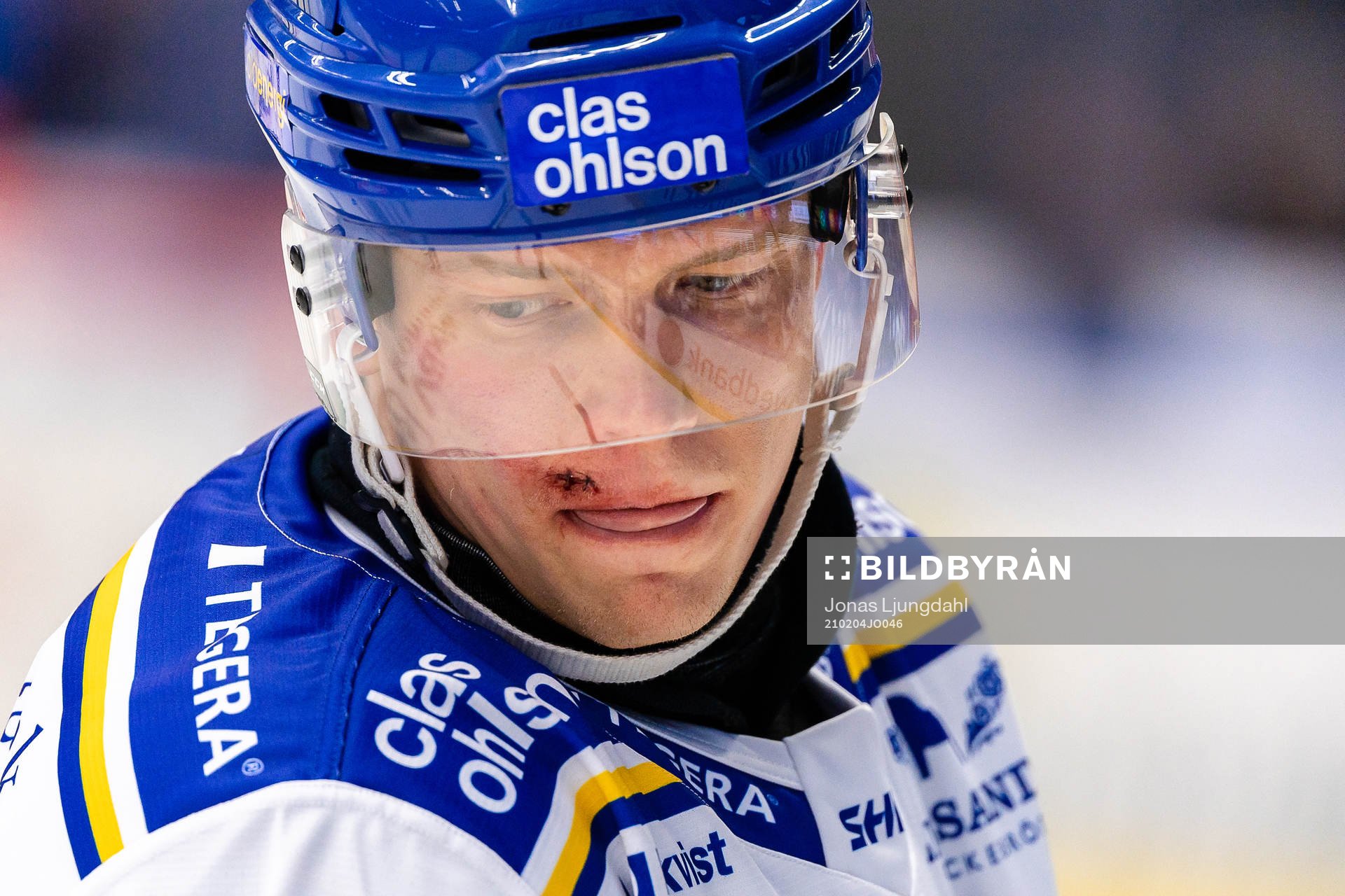 Leksands Patrik Zackrisson med sydd läpp