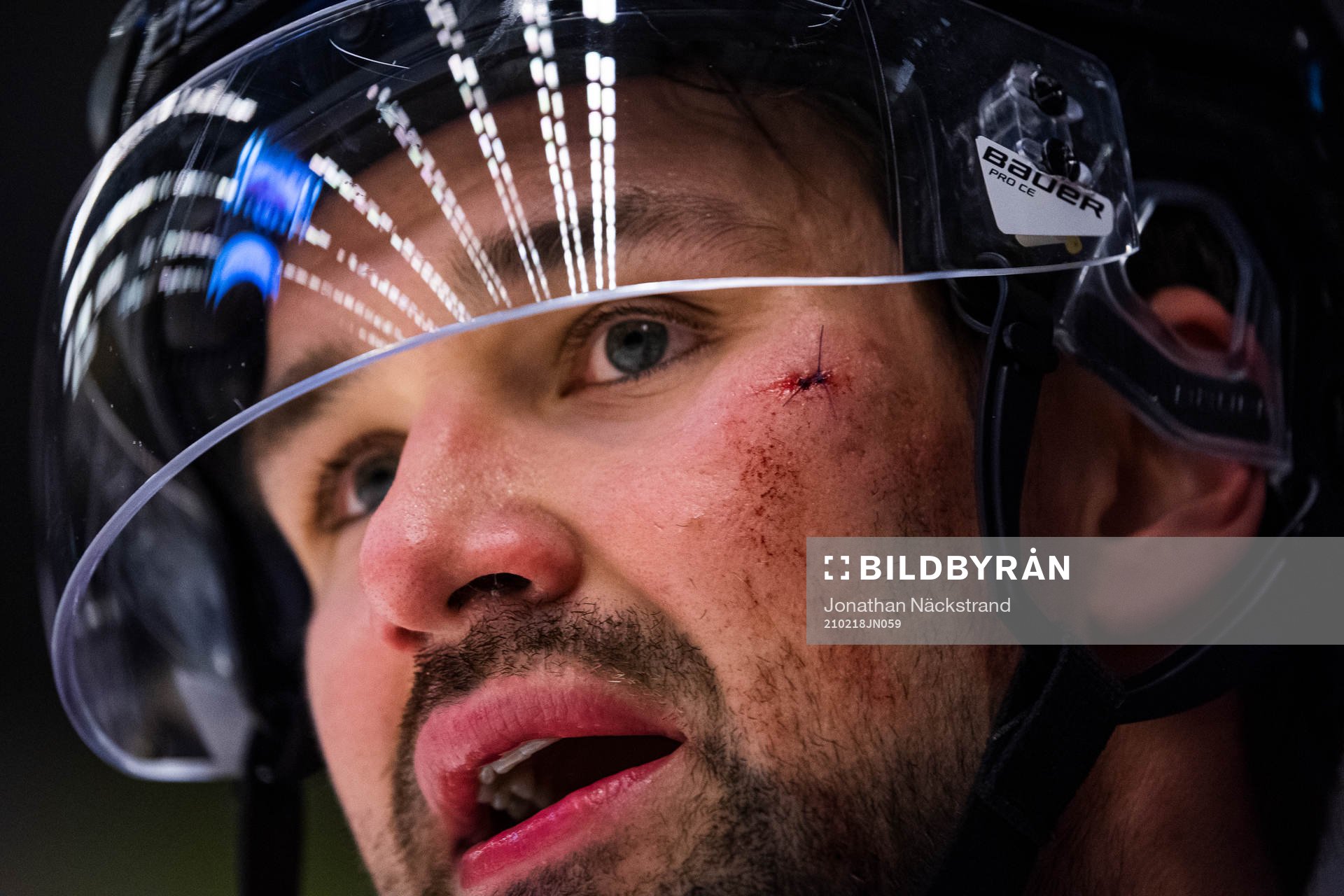Brynäs Johan Alcén med stygn i ansiktet