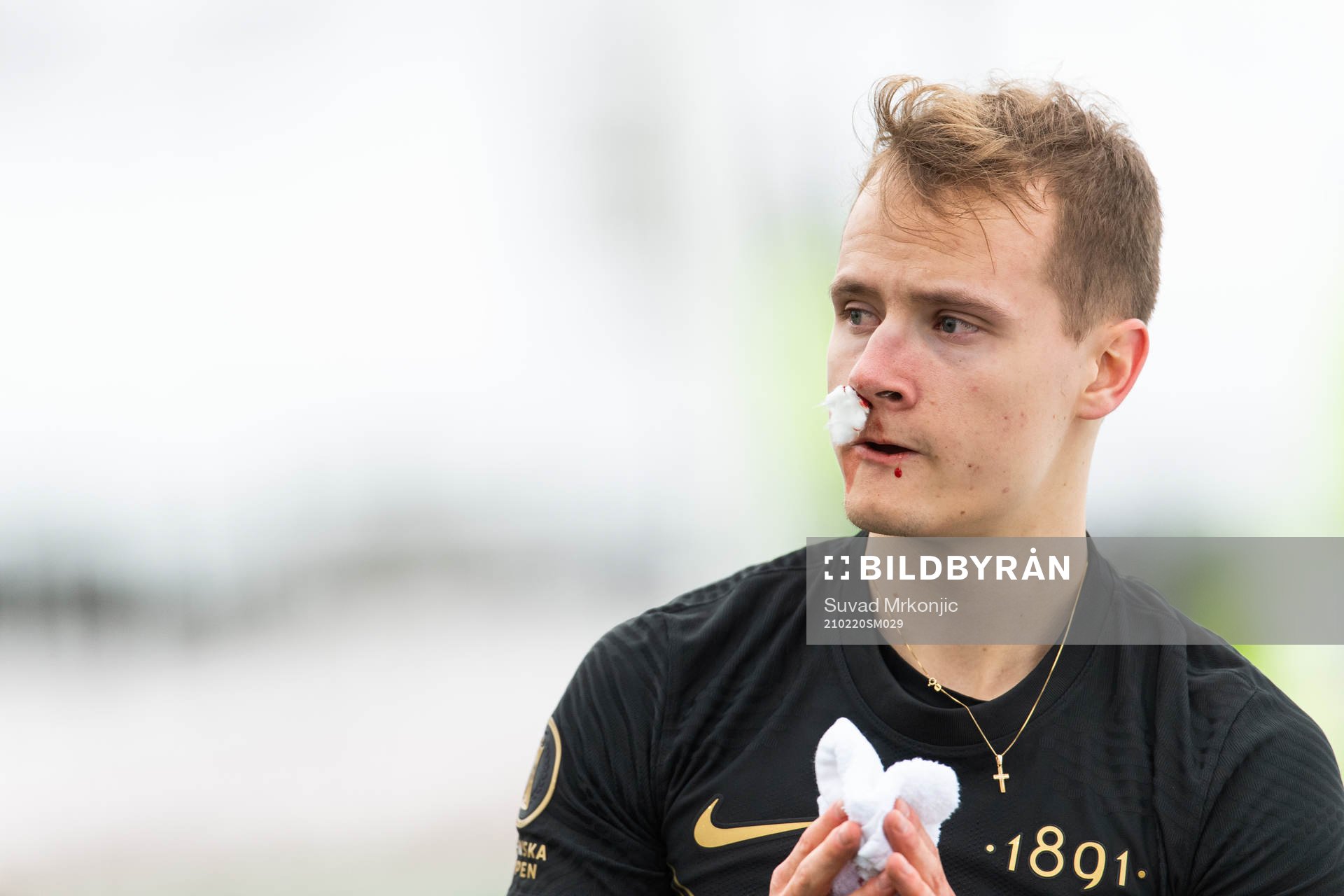s Saku Ylätupa blöder från näsan