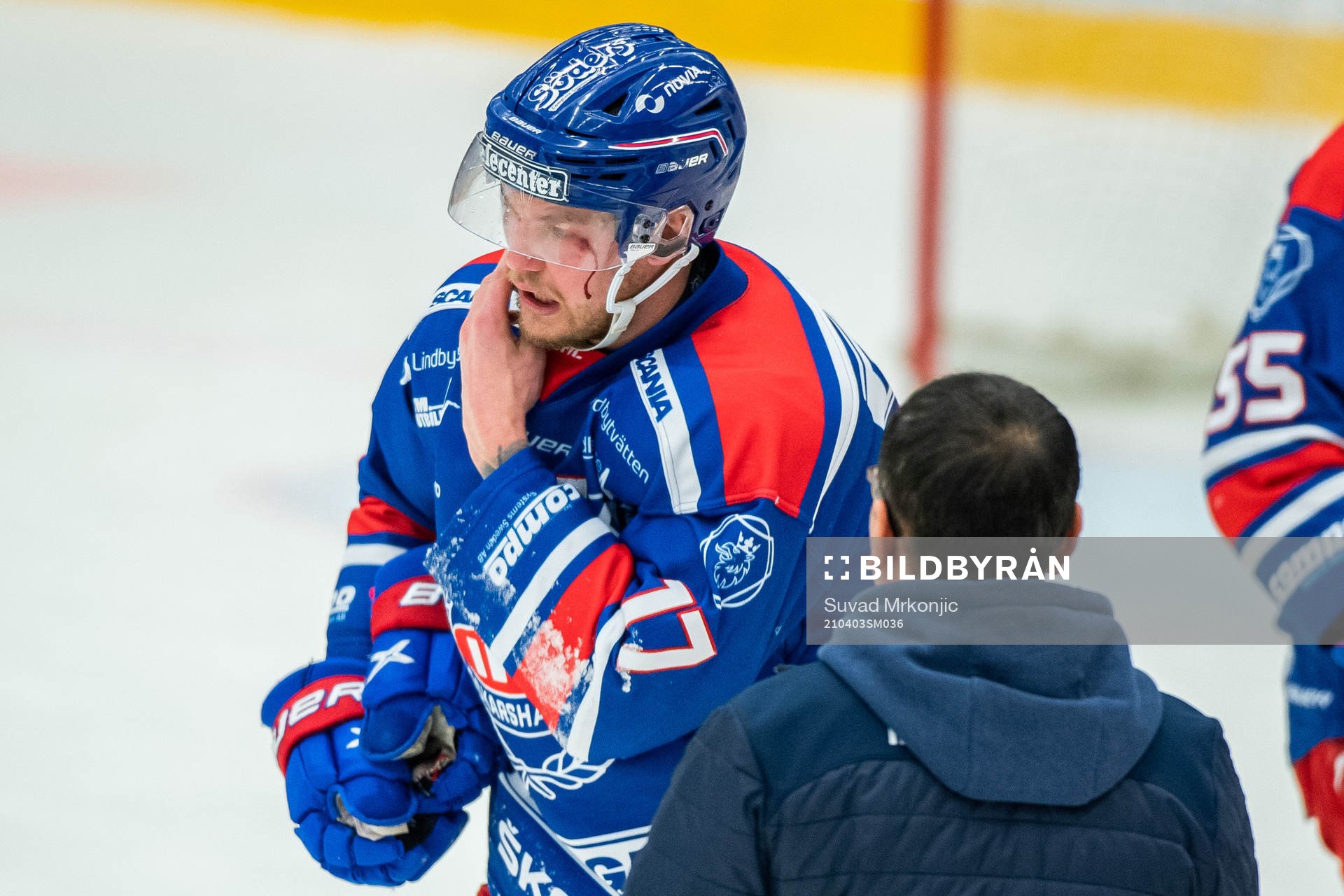 Oskarshamns Jonas Engström blöder från ansiktet
