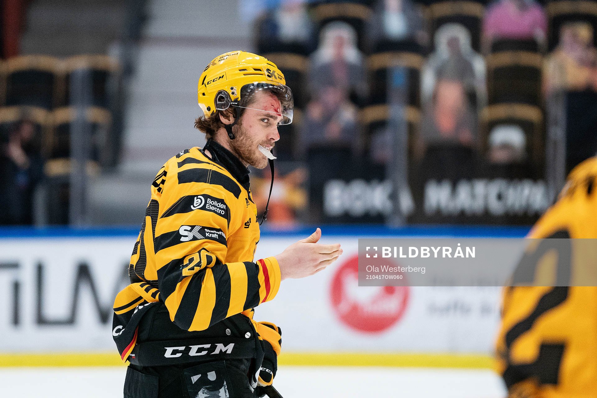 Skellefteås Roland McKeown lämnar isen med blod i pannan