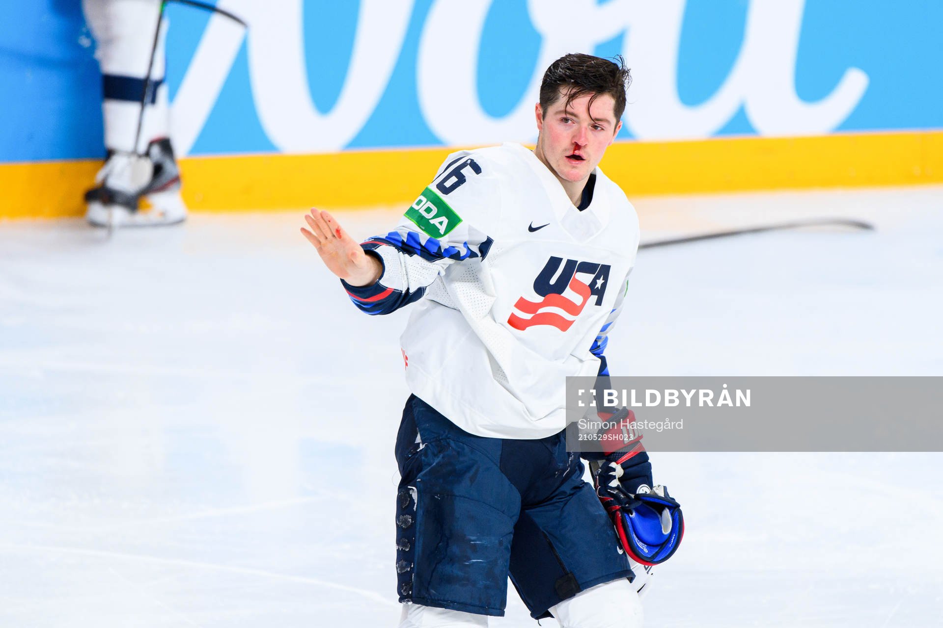 Ryan Donato of USA in pain