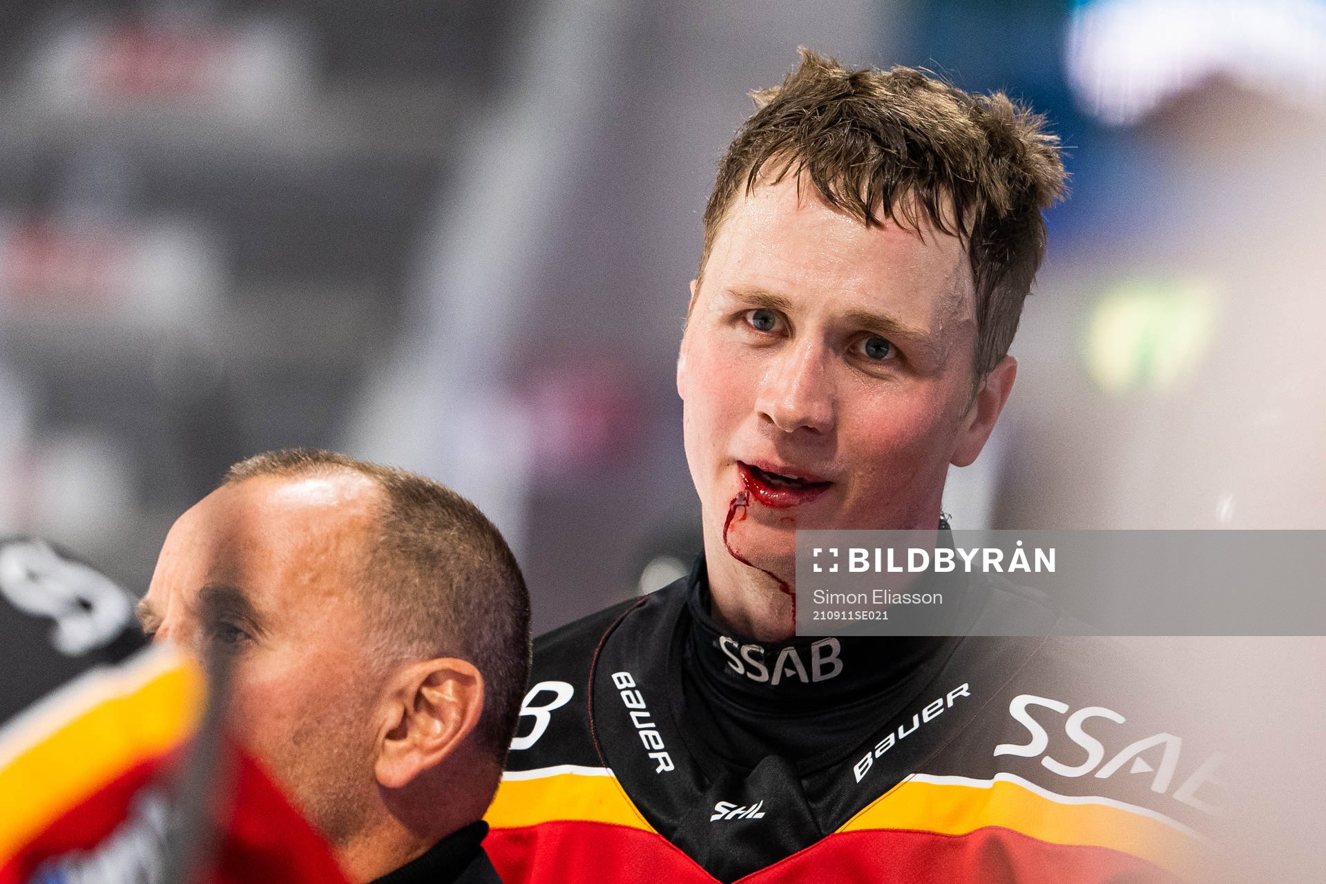 Luleås Jonas Berglund blöder från munnen