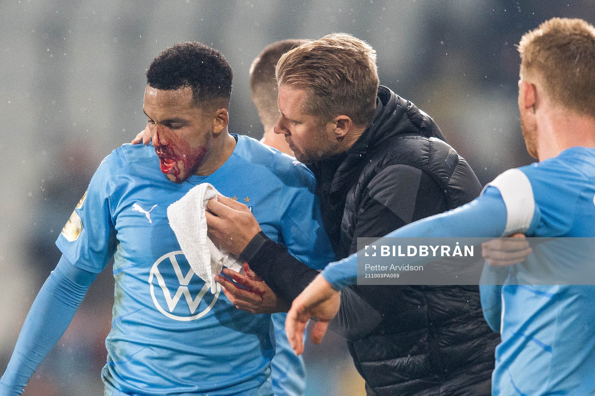 Malmö FFs Martin Olsson blöder från näsan och får vård