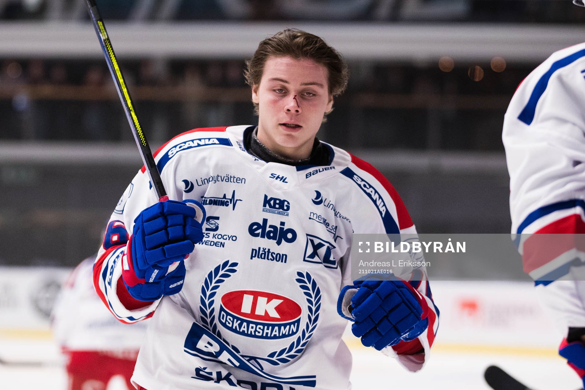 Oskarshamns Emil Lilleberg med en skada på näsan