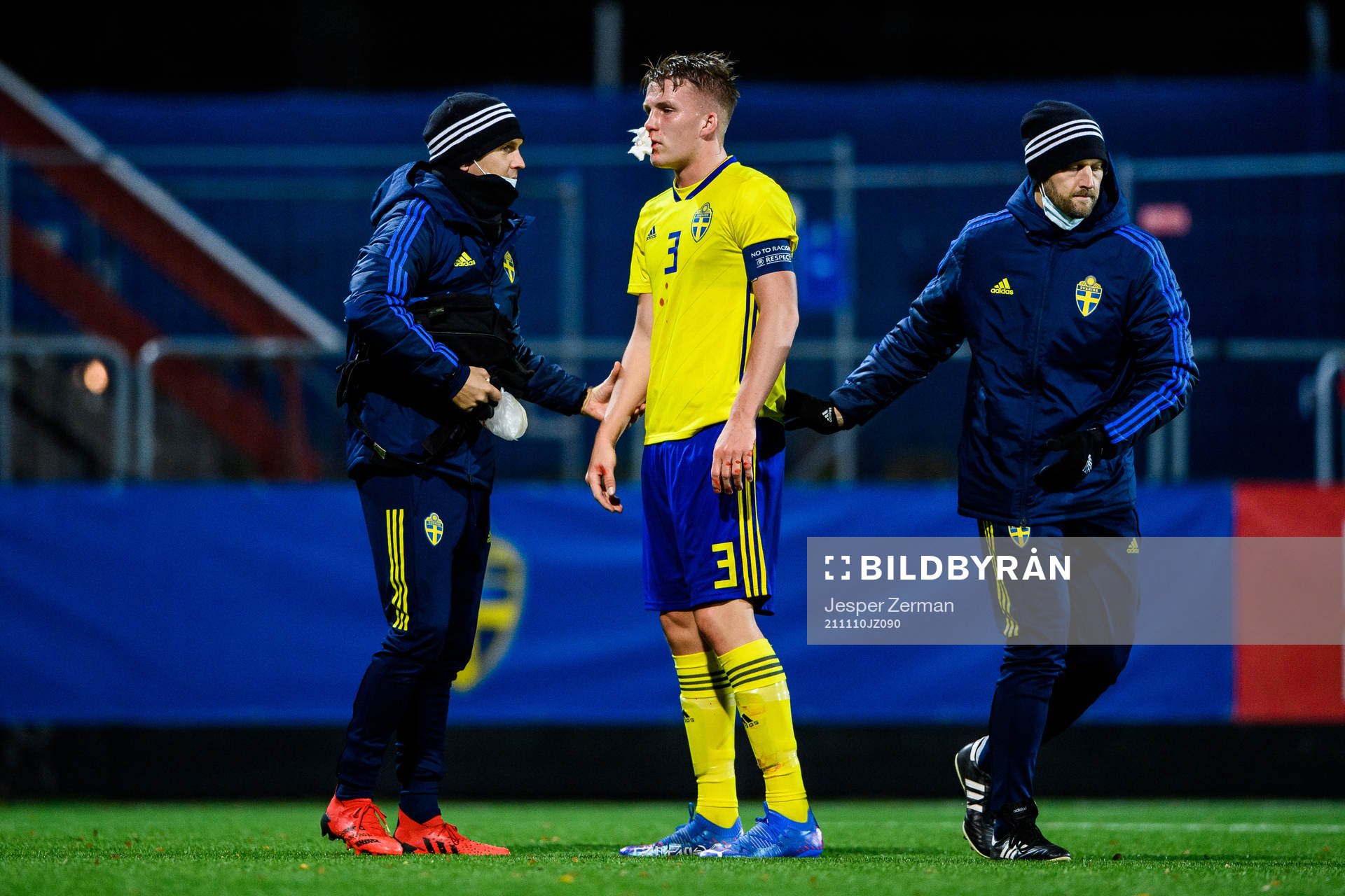 Sveriges Casper Widell blöder från ansiktet