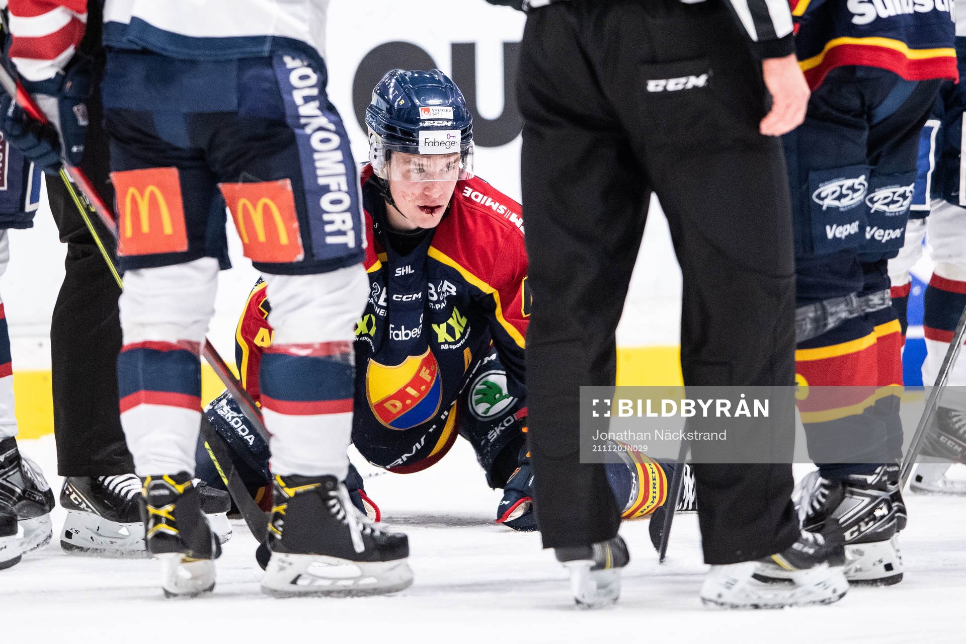 Djurgårdens Tom Nilsson blöder från munnen