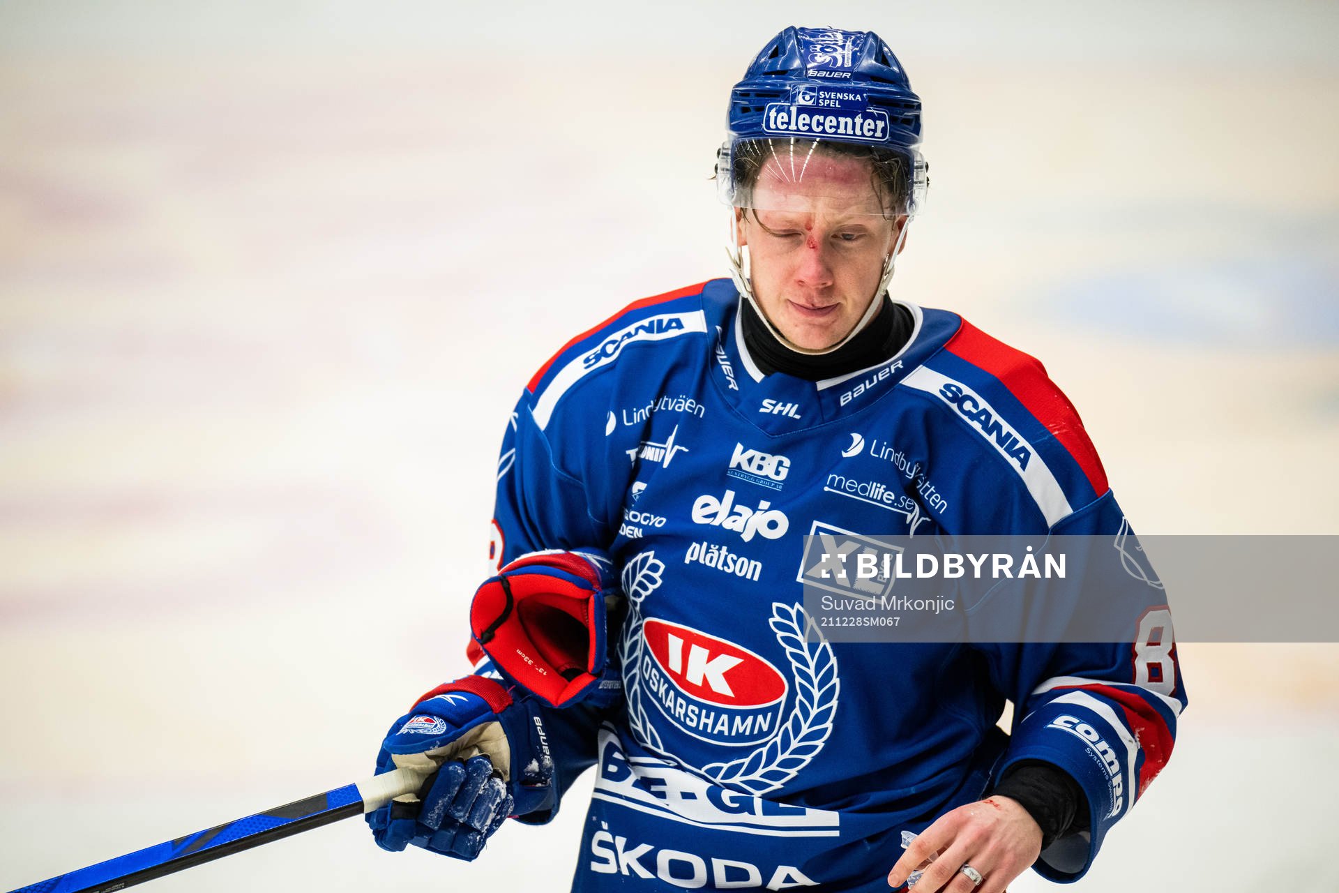 Oskarshamns Fredrik Olofsson blöder