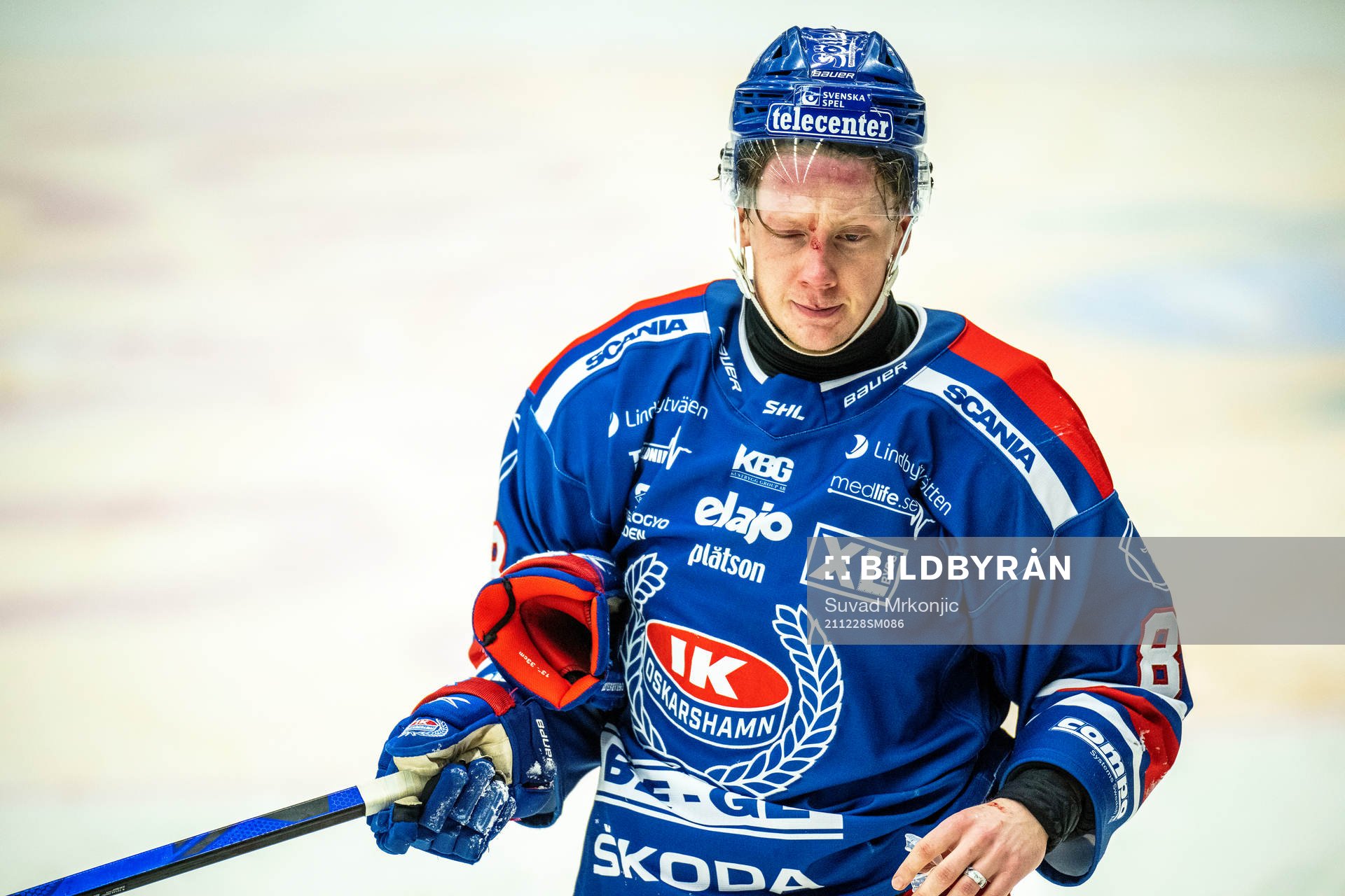 Oskarshamns Fredrik Olofsson blöder