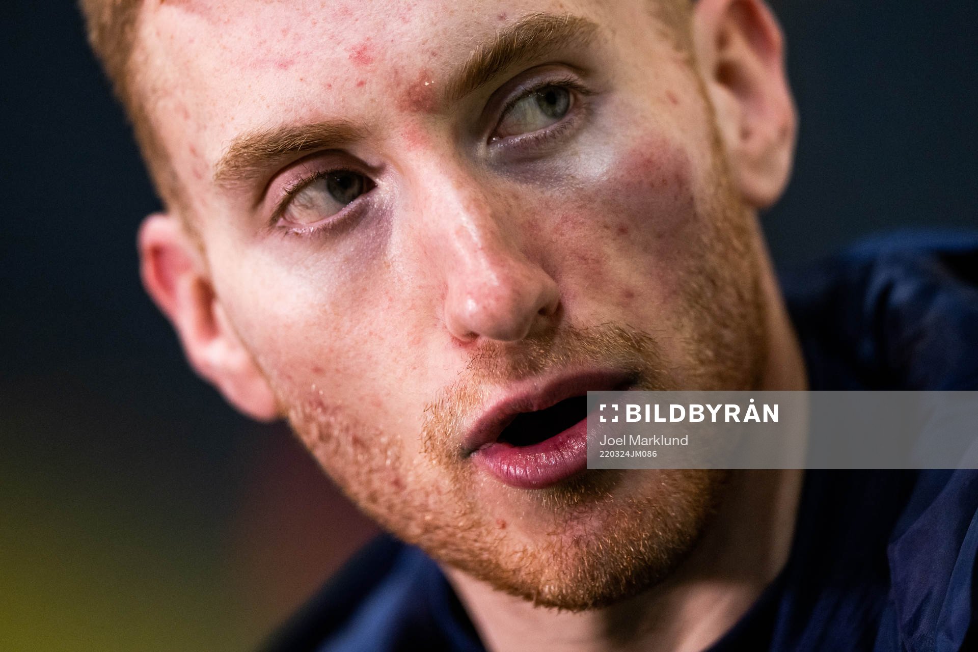 Dejan Kulusevski of Sweden, with a bruise