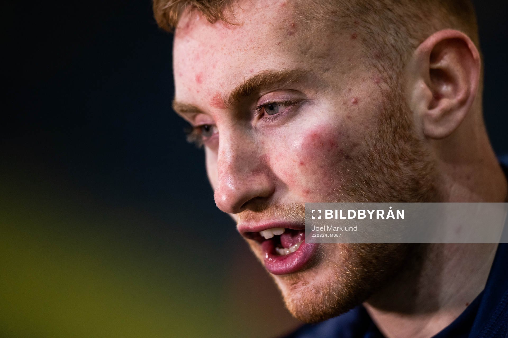 Dejan Kulusevski of Sweden, with a bruise