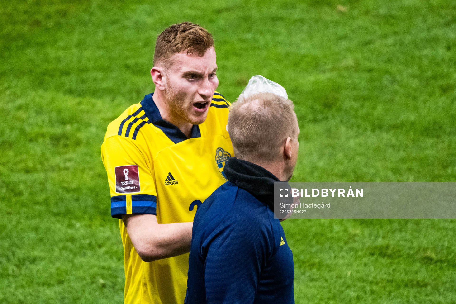 Dejan Kulusevski of Sweden with a bruise