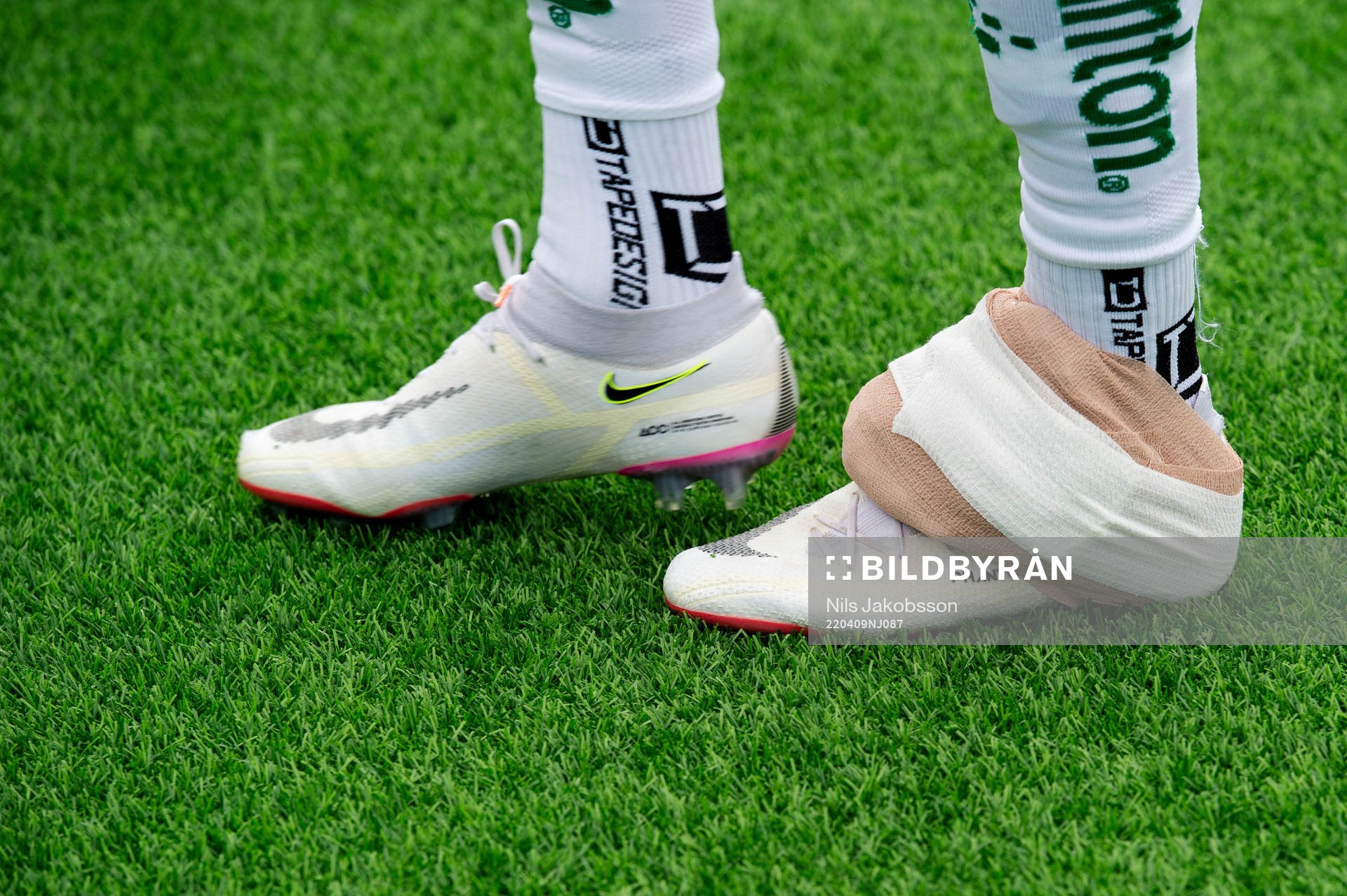 Hammarbys Richard Magyar har en lindad fot
