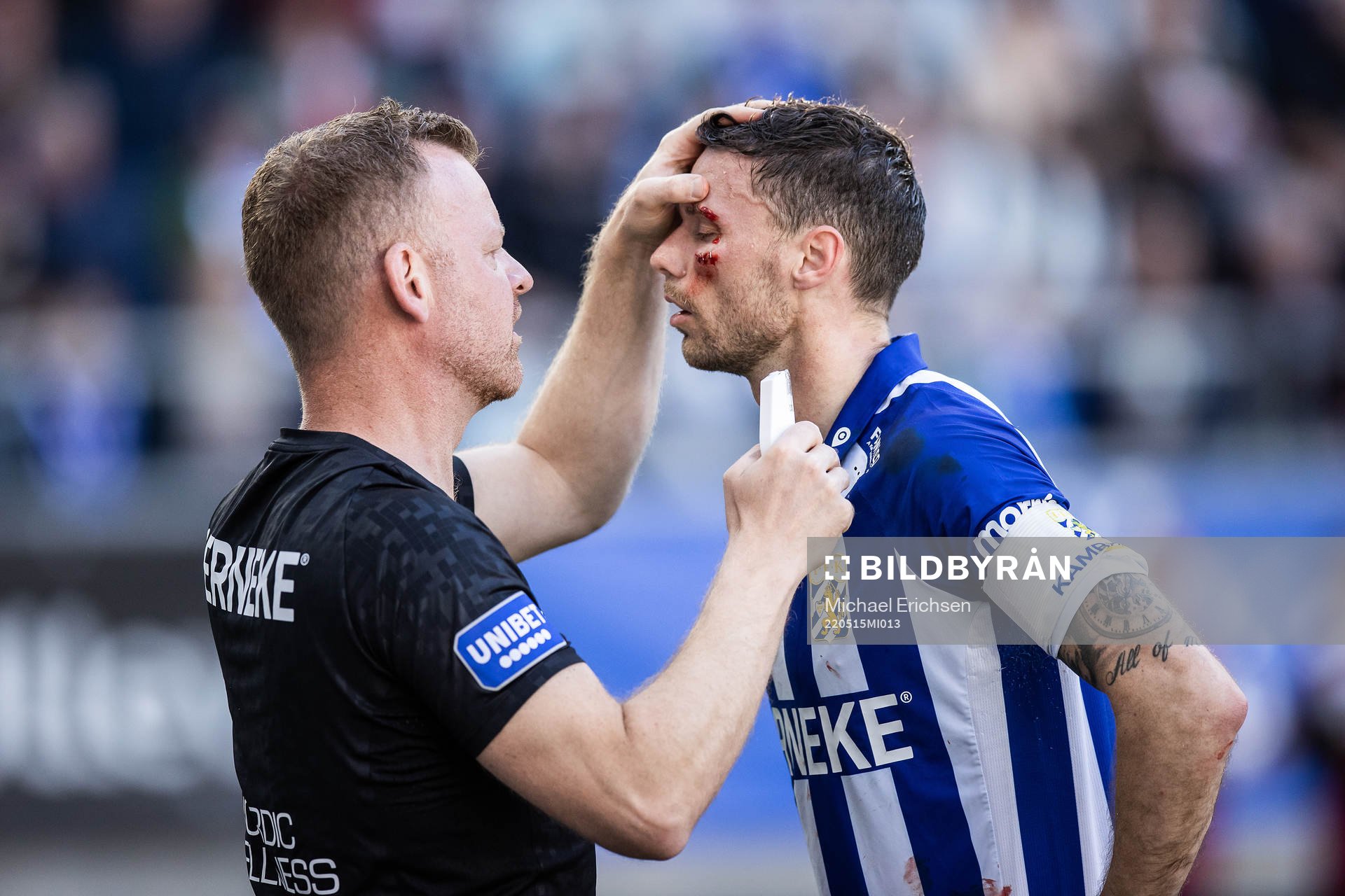 IFK Göteborgs Marcus Berg får sitt sår hophäftat