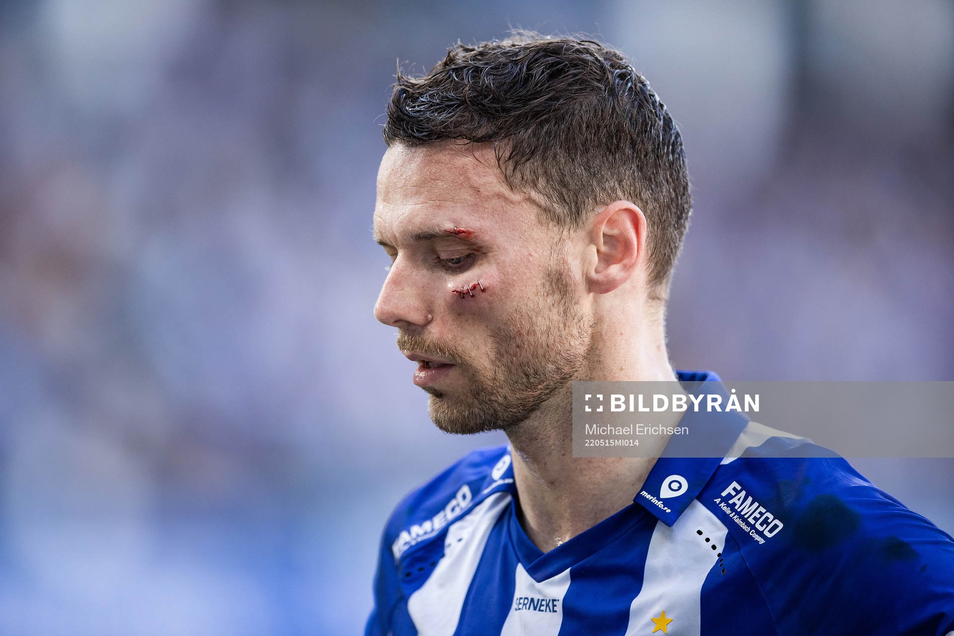 IFK Göteborgs Marcus Berg har fått vård
