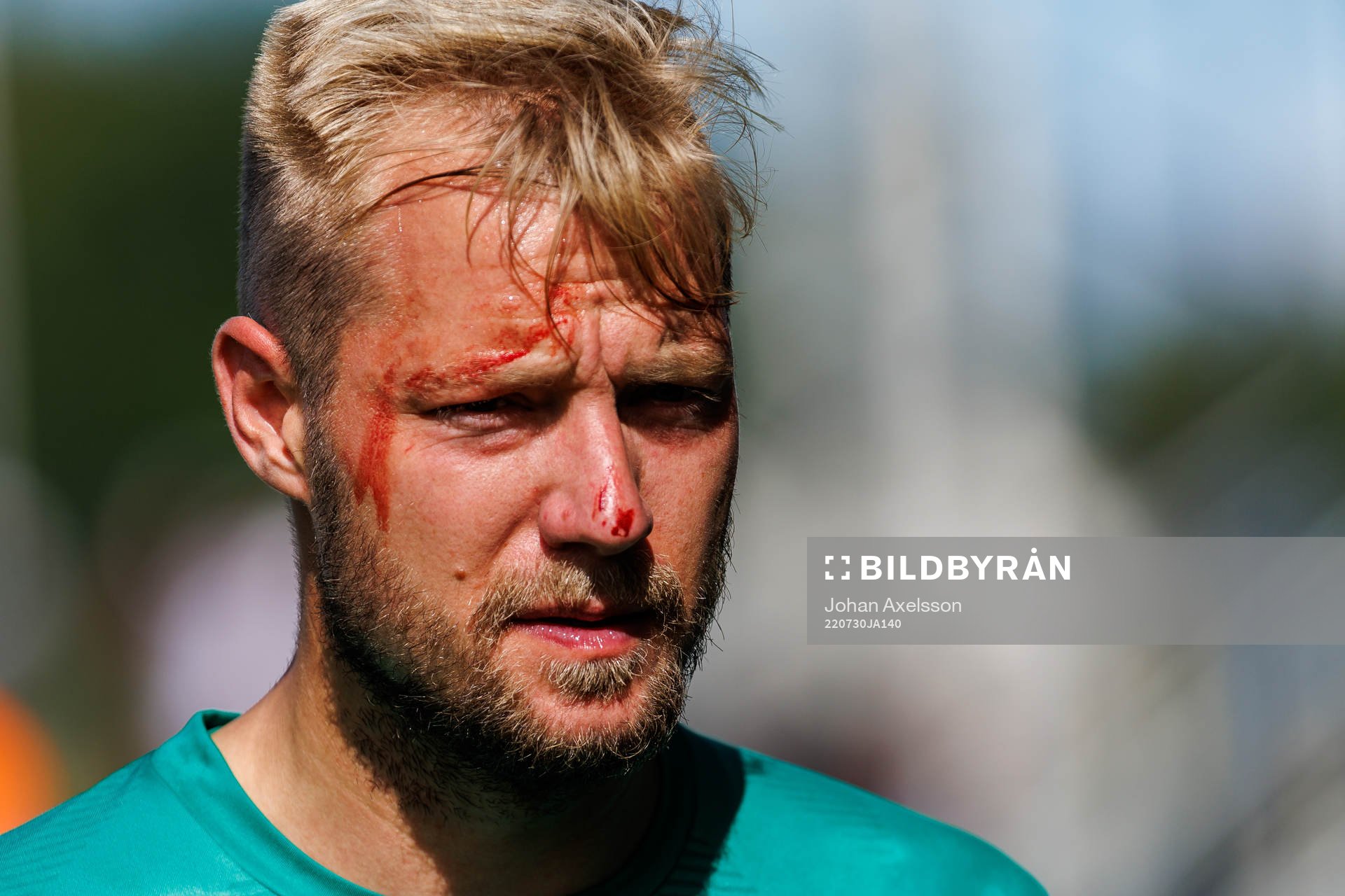 Jönköpings Sebastian Crona med blod i ansiktet