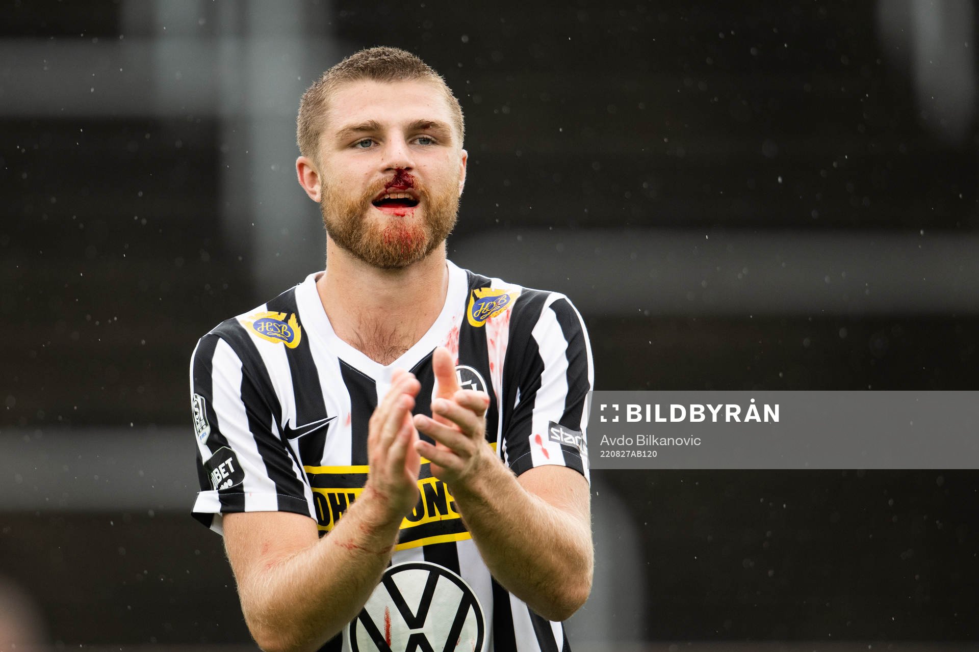 Landskronas Erik Hedenquist  med blodig näsa