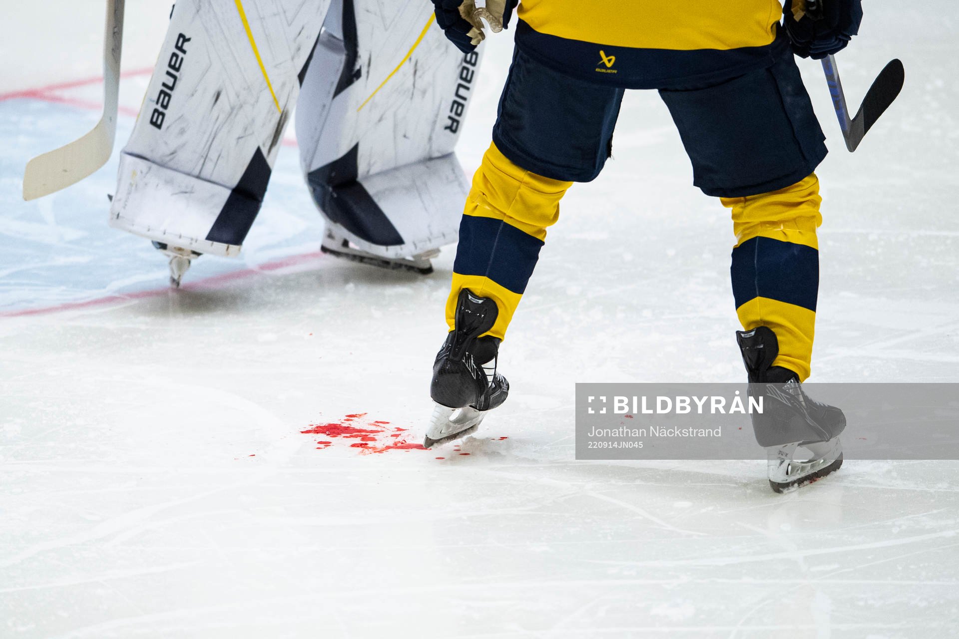 s Emil Andrae ha träffas av en puck i ansiktet