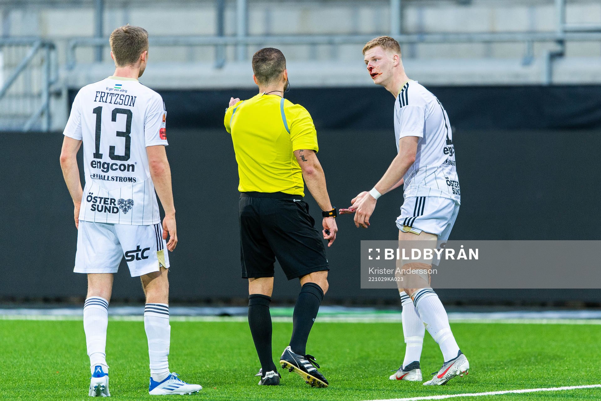 Östersunds Malcolm Stolt blöder ur näsan och reagerar