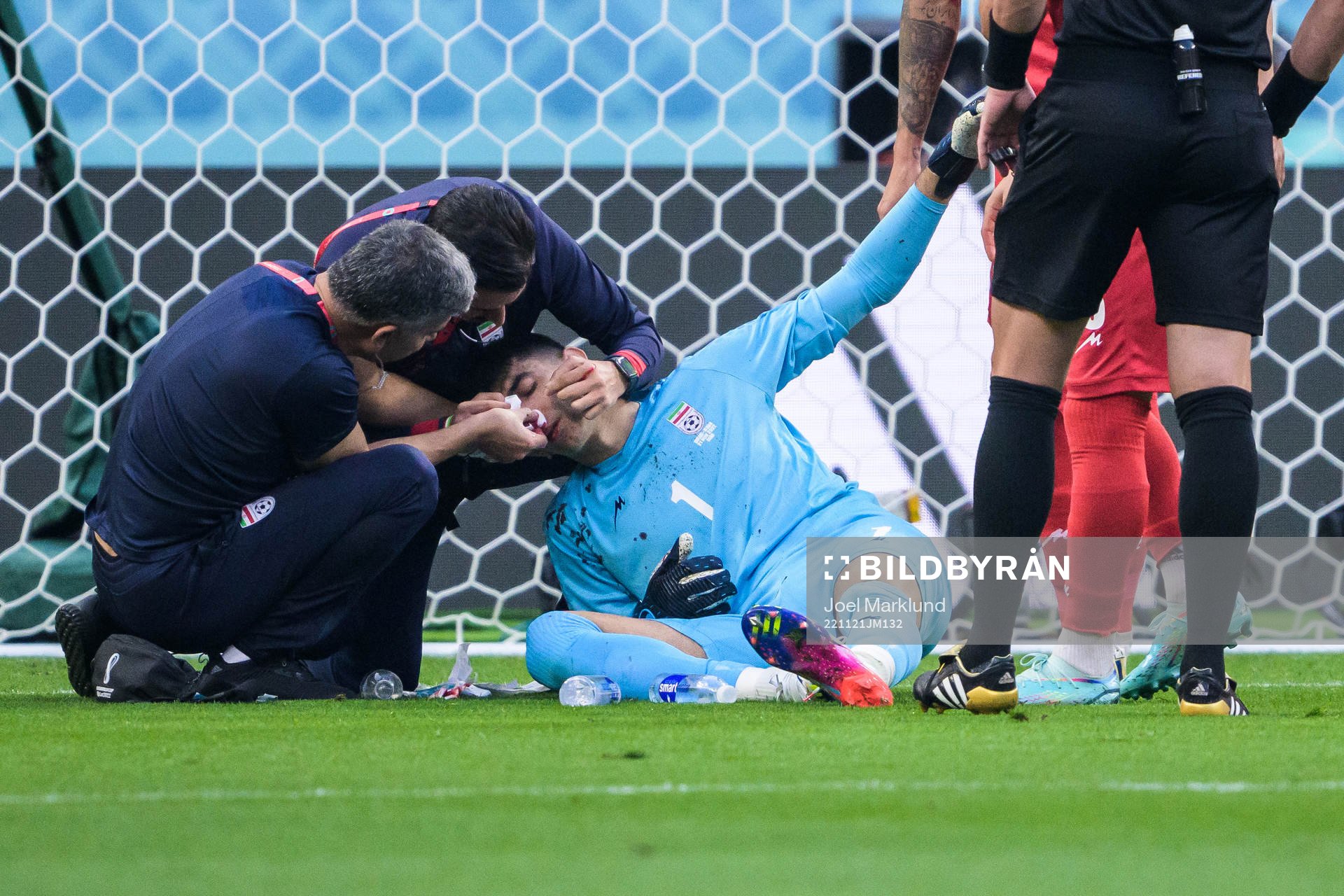 Goalkeeper Alireza Beiranvand of Iran receives medical