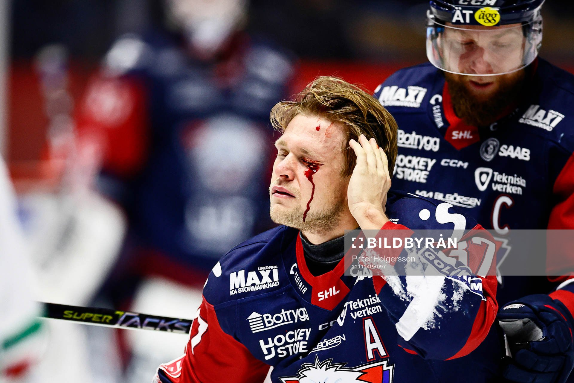Linköpings Jesper Pettersson skadad vid ögat