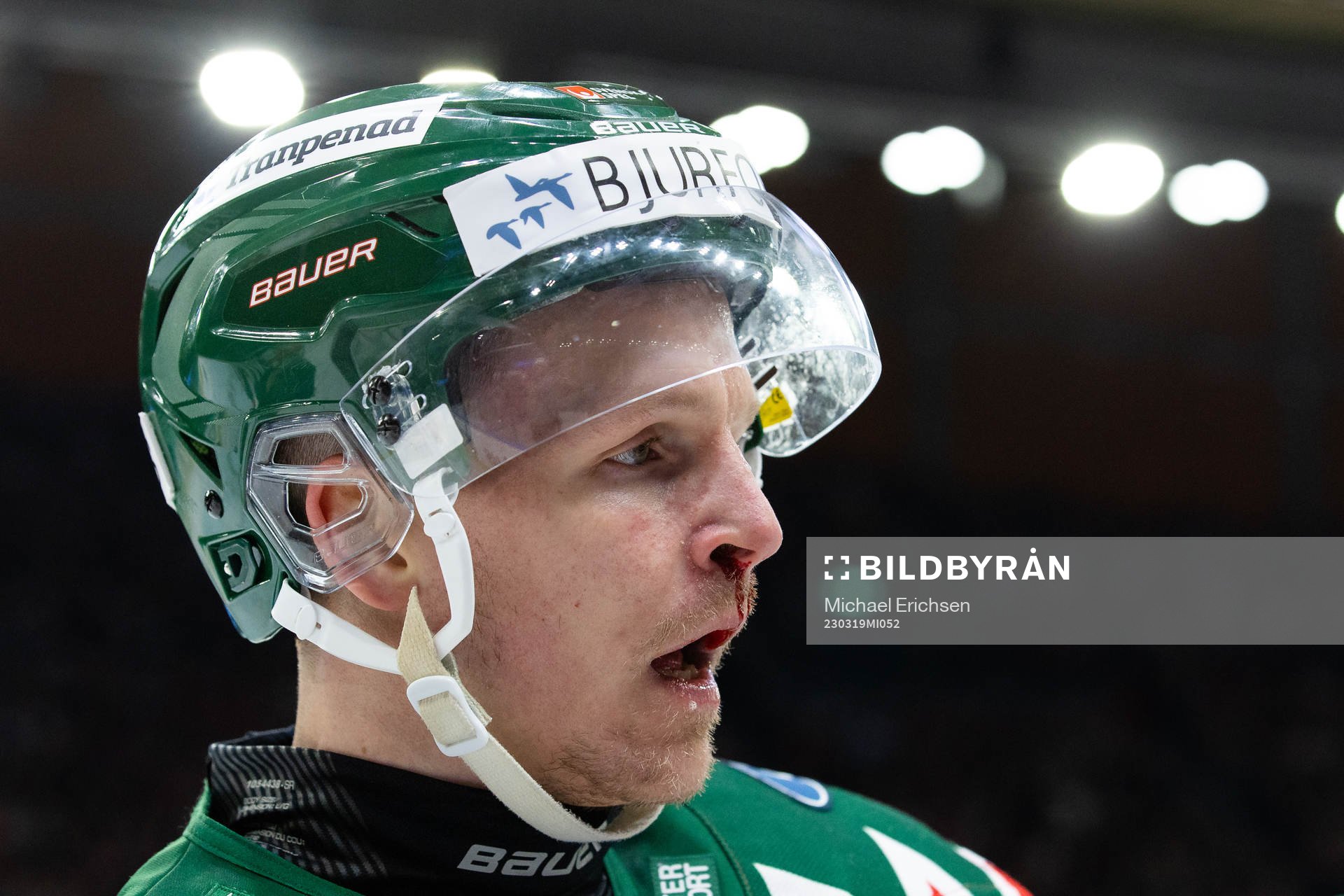 Frölundas Max Friberg blöder från näsan