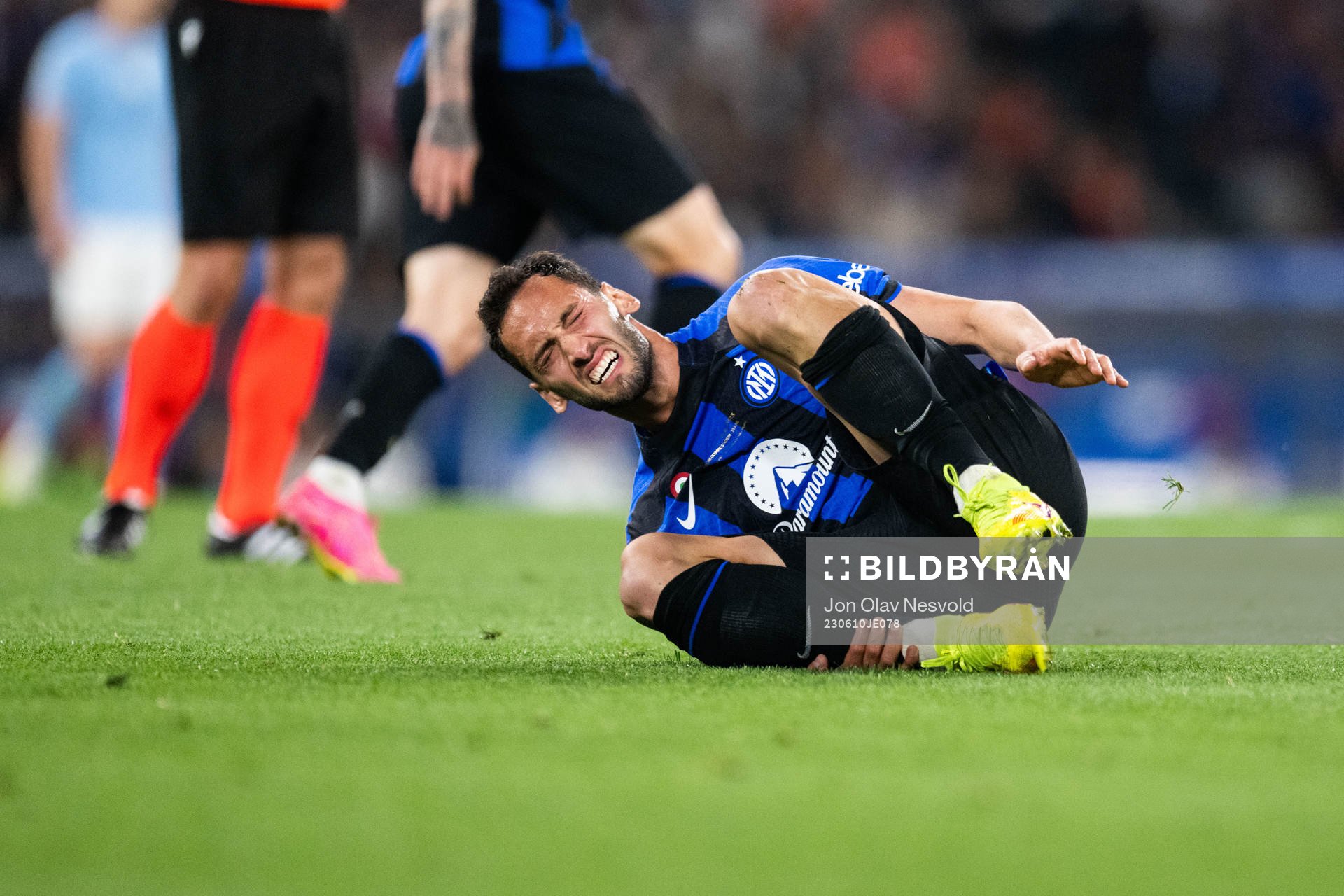 Hakan Calhanoglu of Inter in pain