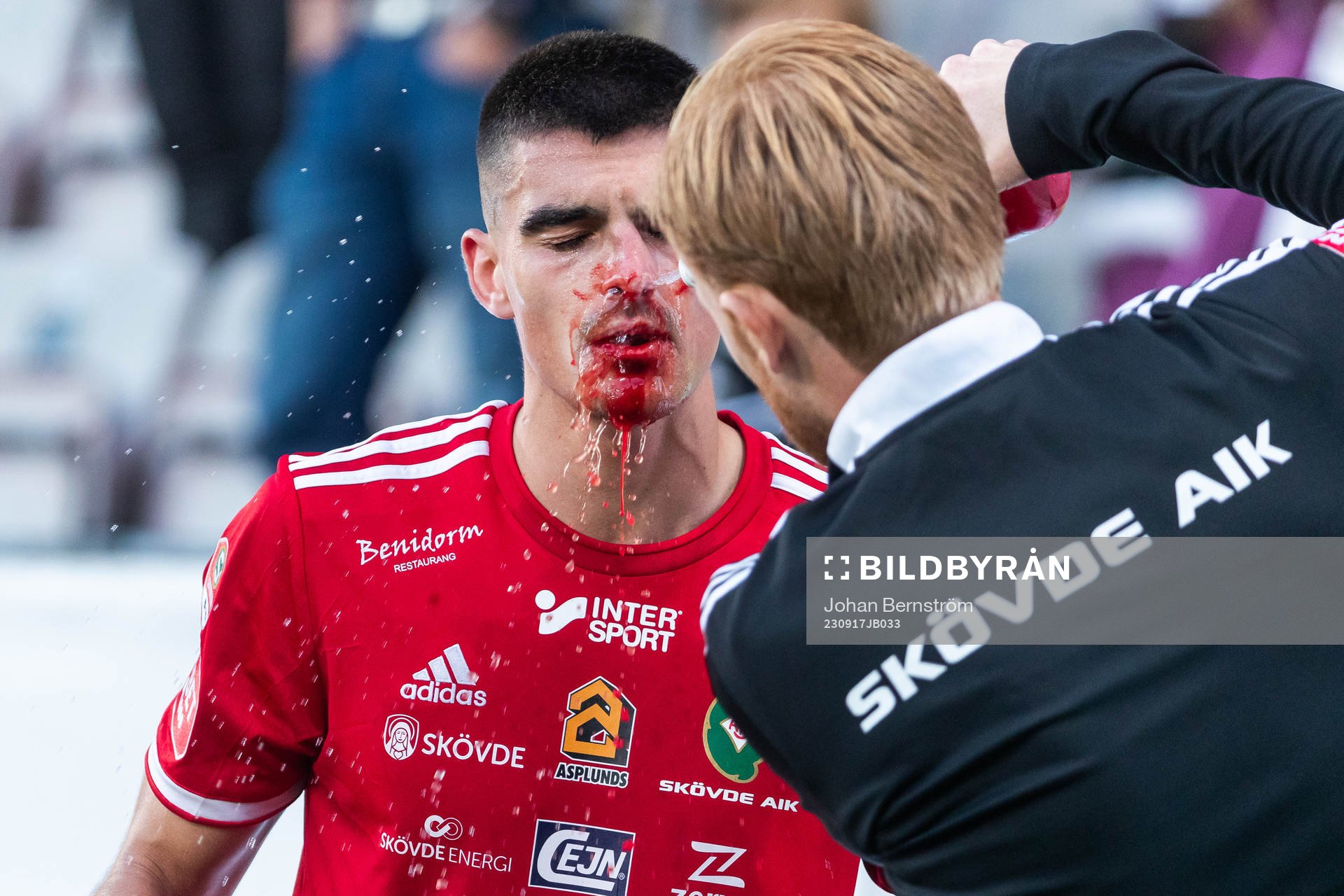 Skövde AIKs Hampus Söderström blöder från ansiktet